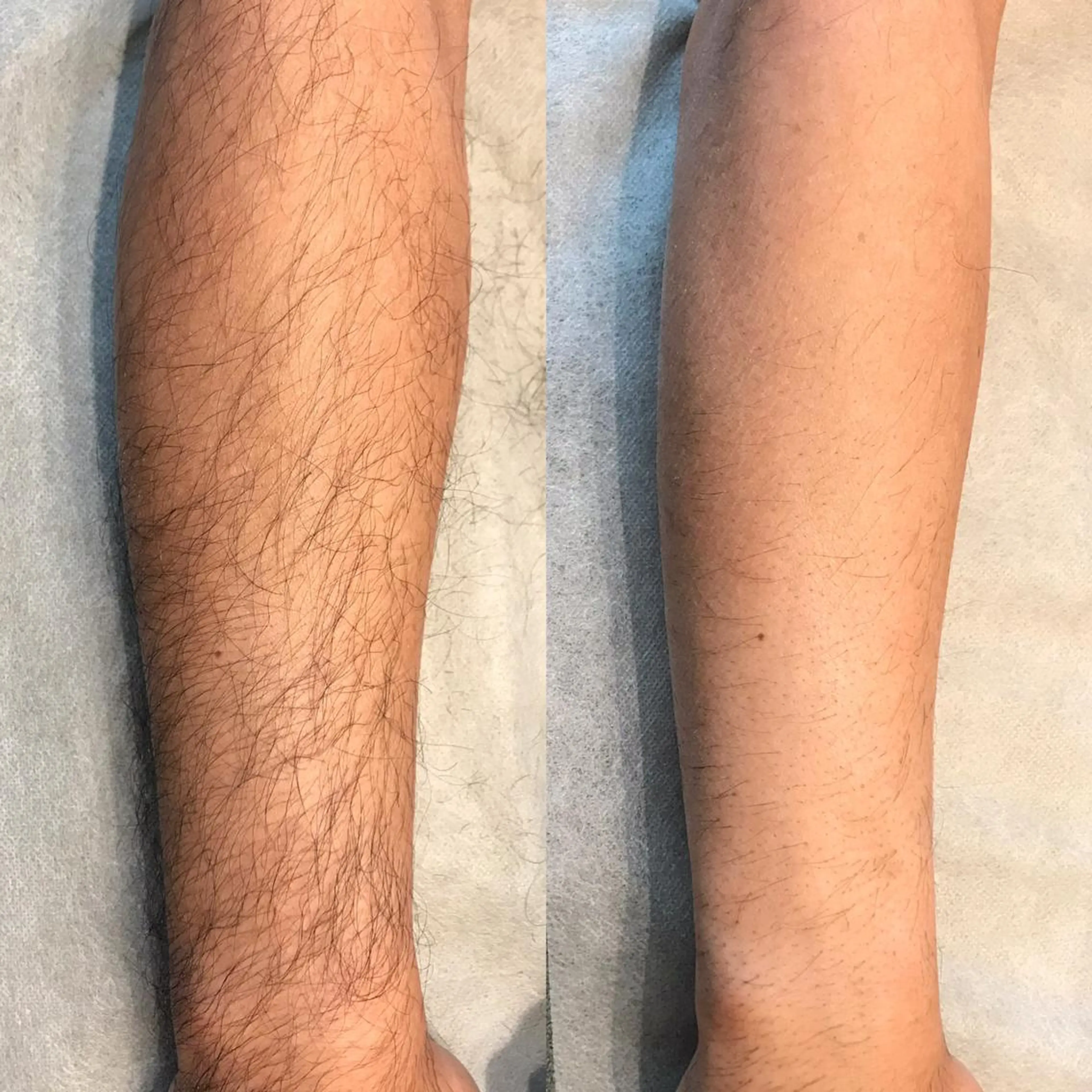 ビューティーサロン リノアのエステ・リラクイメージ