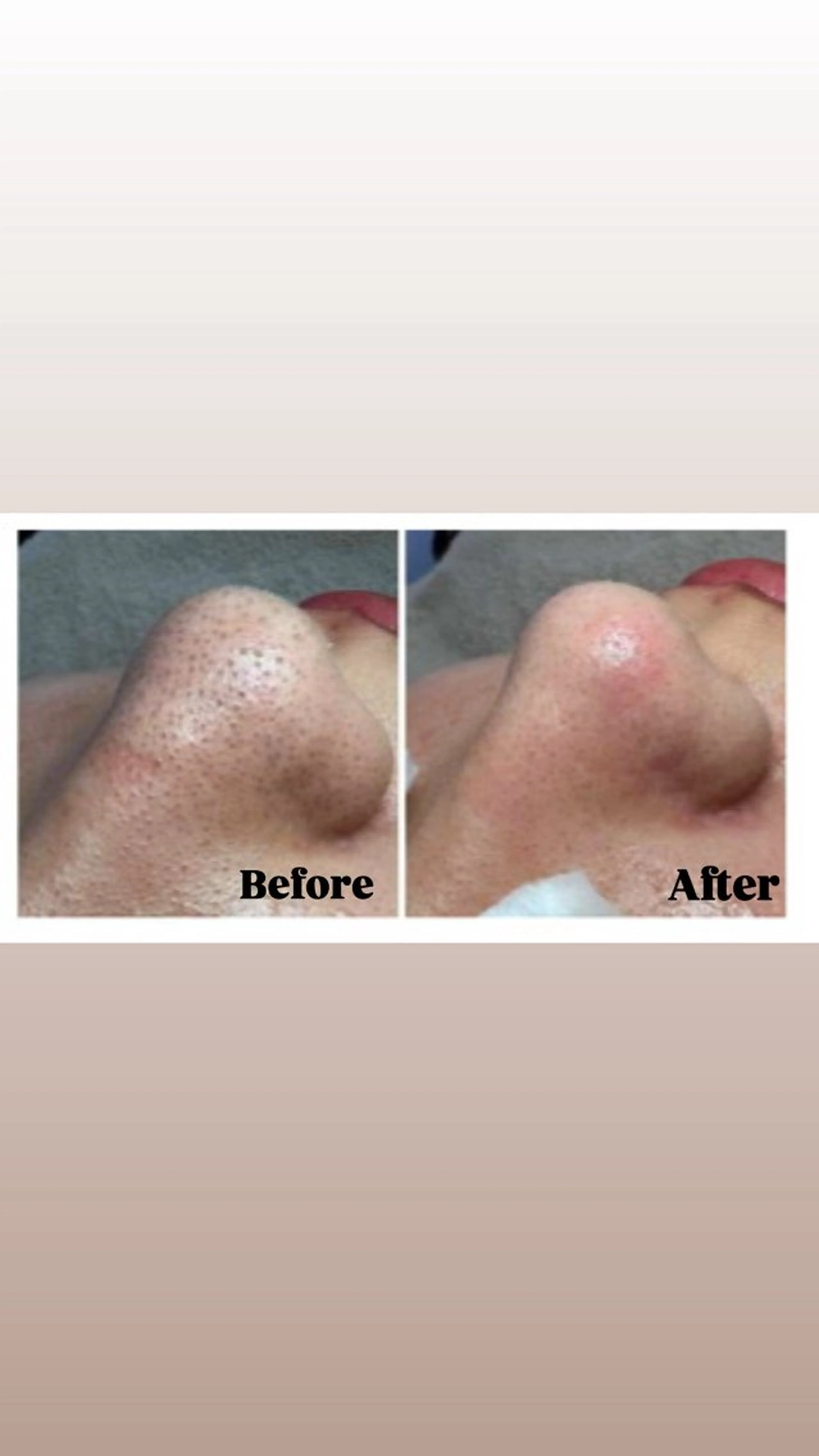 エステ Éclat de Belle🫧白玉肌のその他イメージ