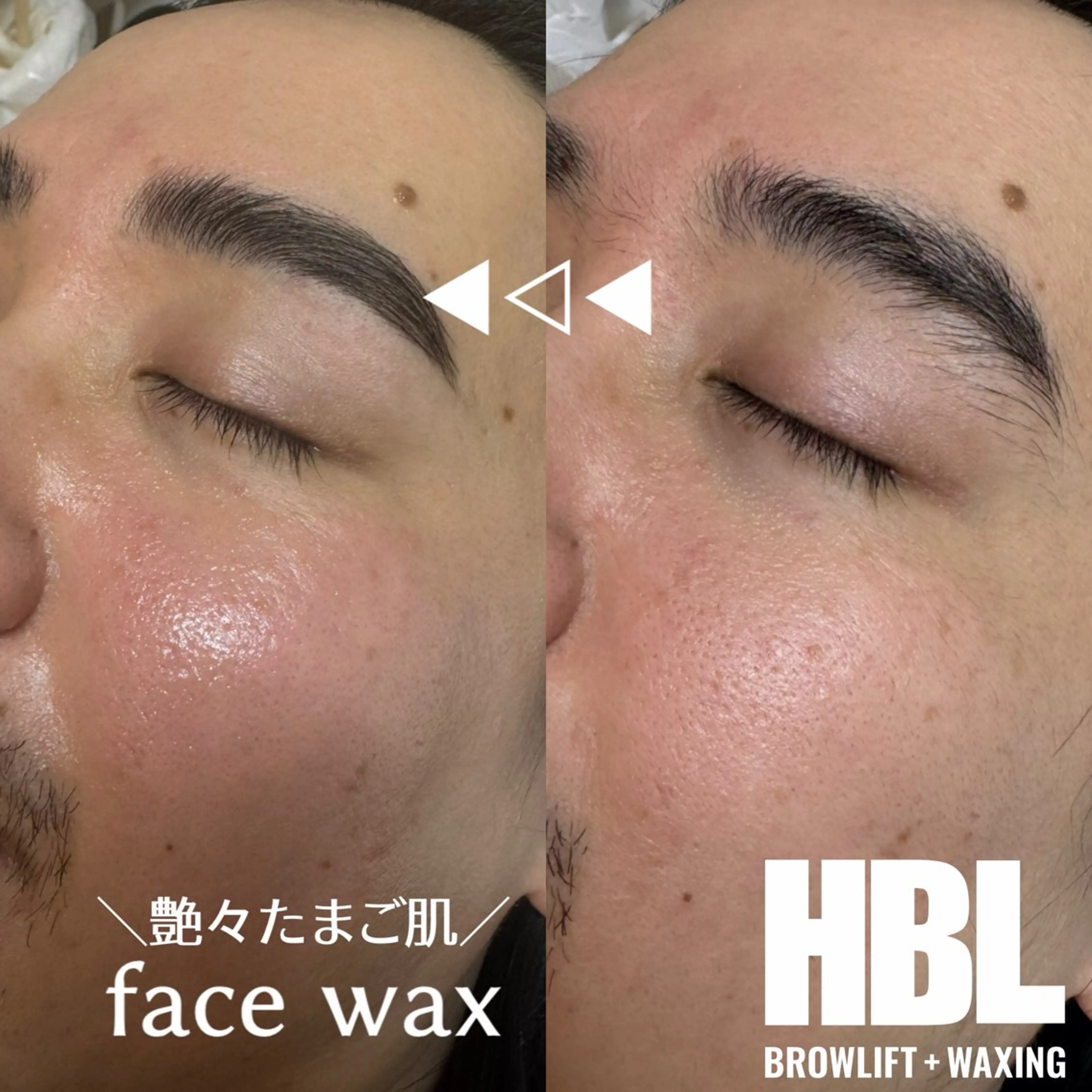 ご新規様📣💕HBL-眉癖改善-&艶々-face wax-たまご肌全顔60minの写真