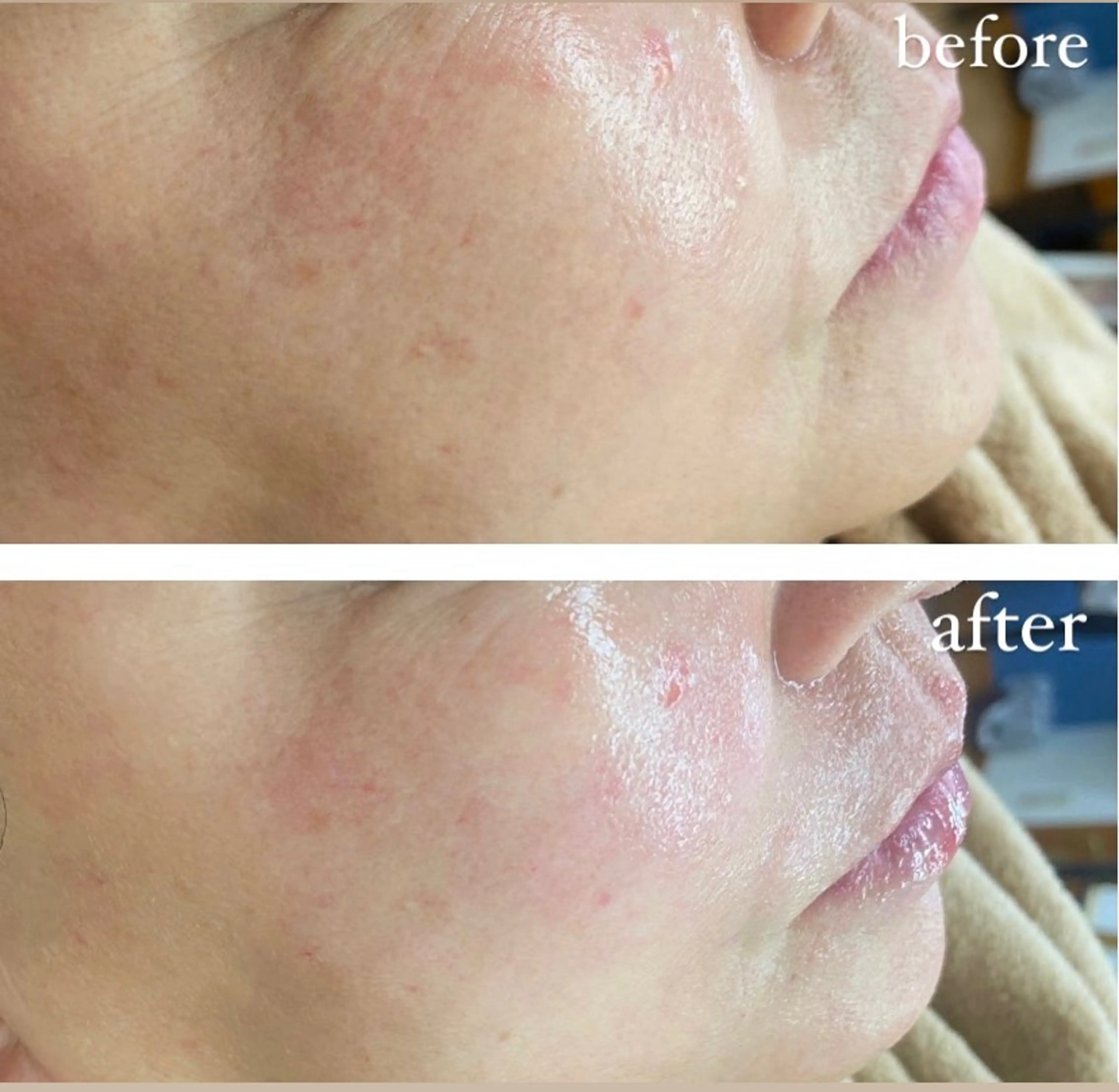 韓国美容肌管理✨スキンジェクションプロの写真