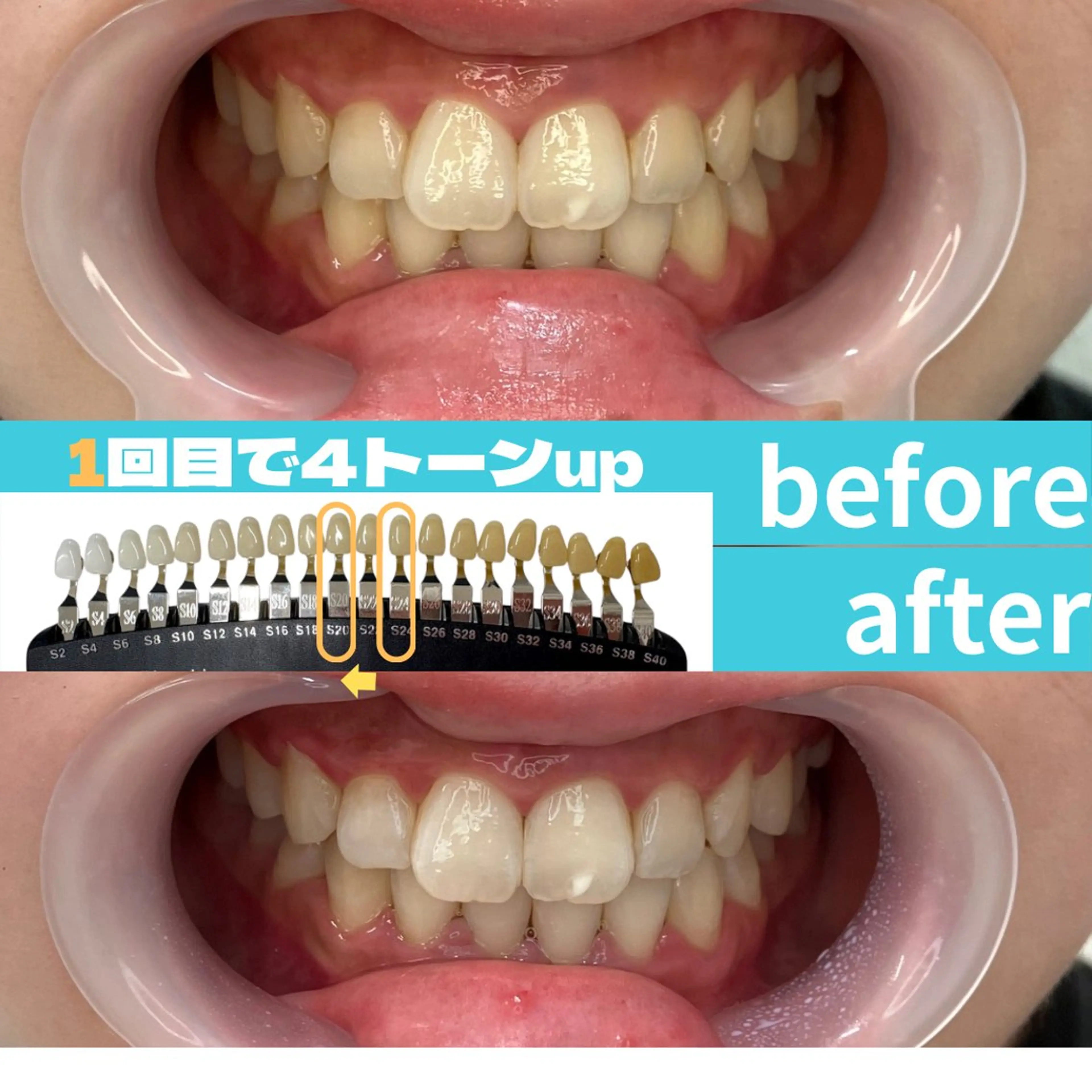 エステ s rikoのエステ・リラクイメージ