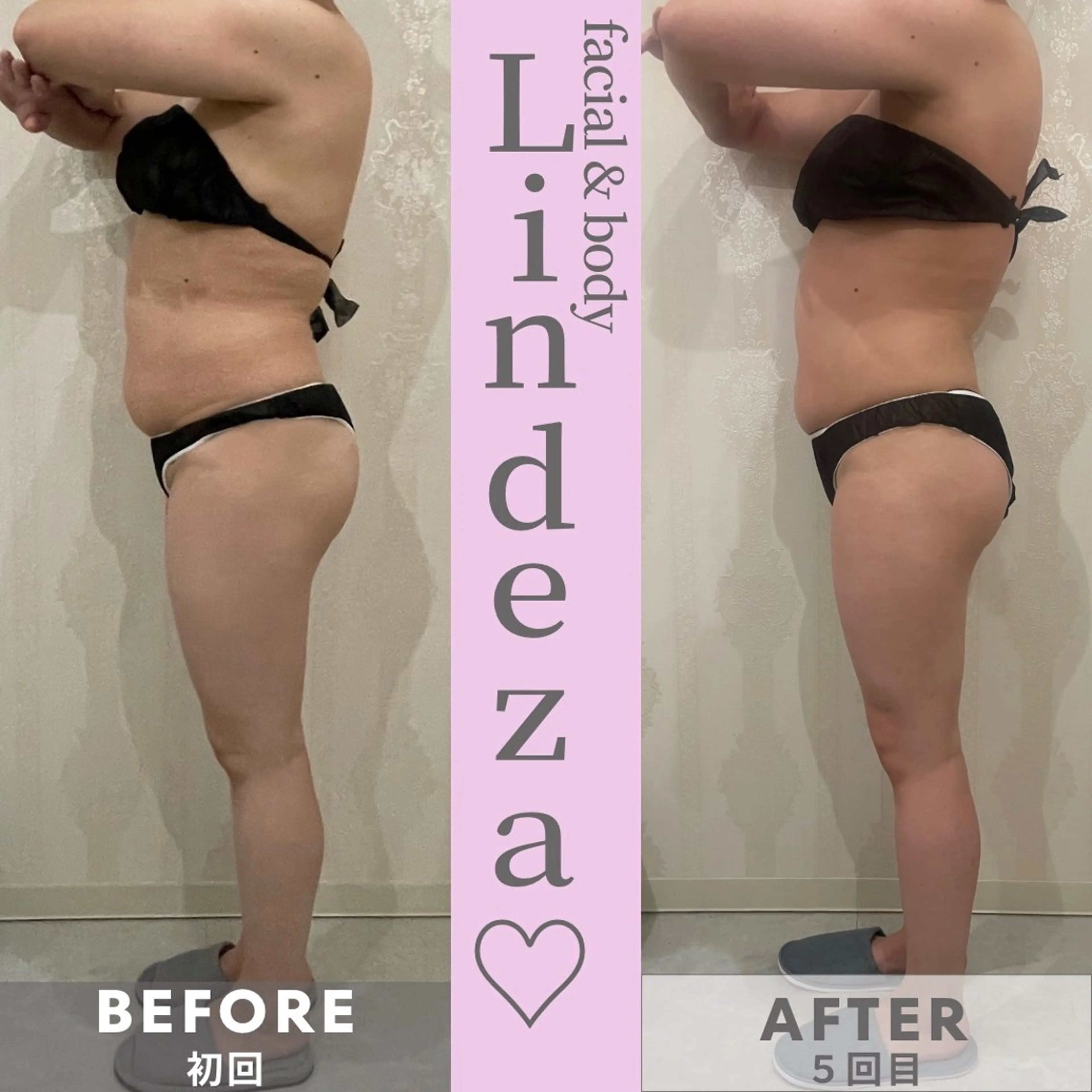 リンデザ 山口のエステ・リラクイメージ