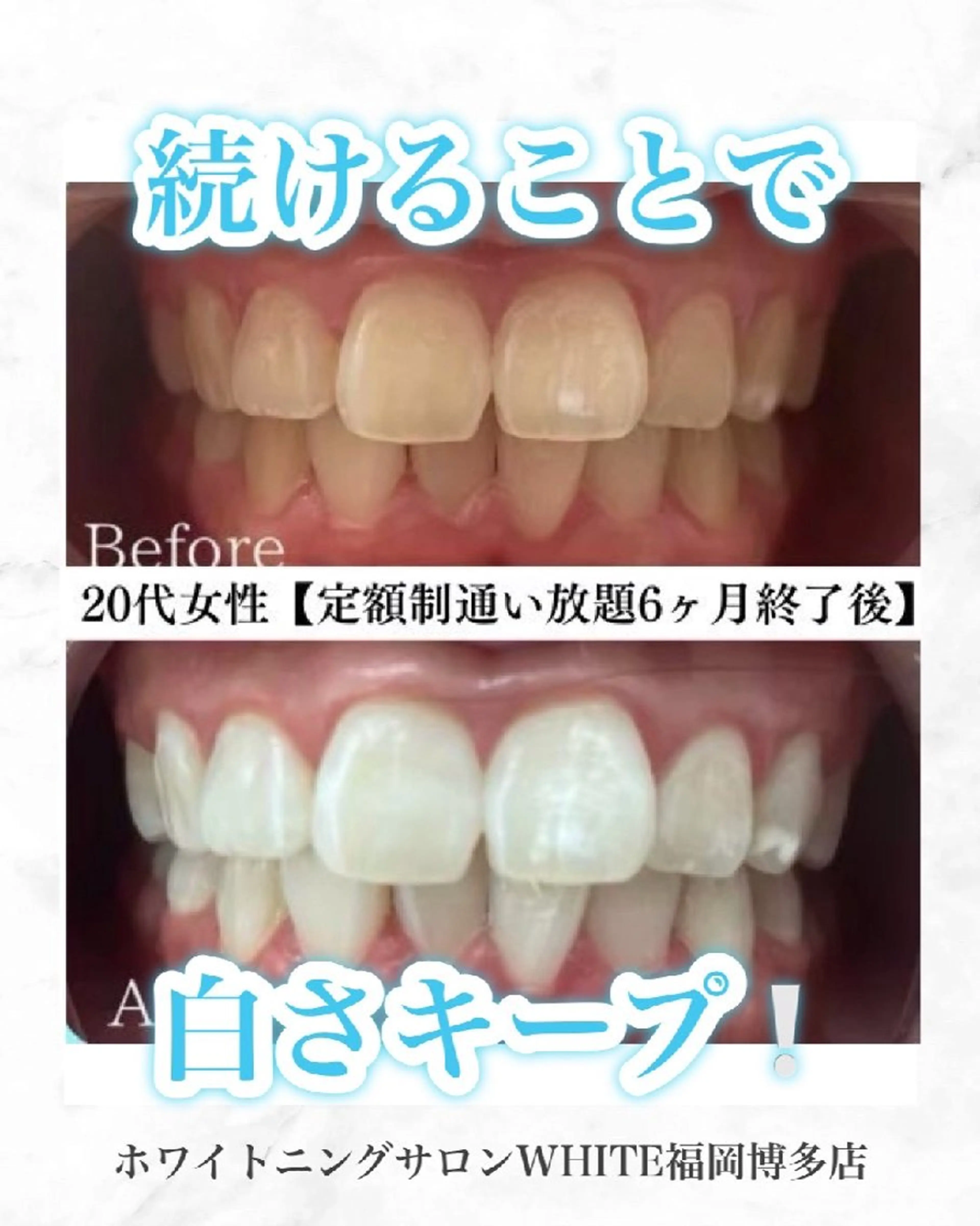 メンズ キッズ エステ リラク セルフホワイトニング WHITE福岡博多店のエステ・リラクイメージ