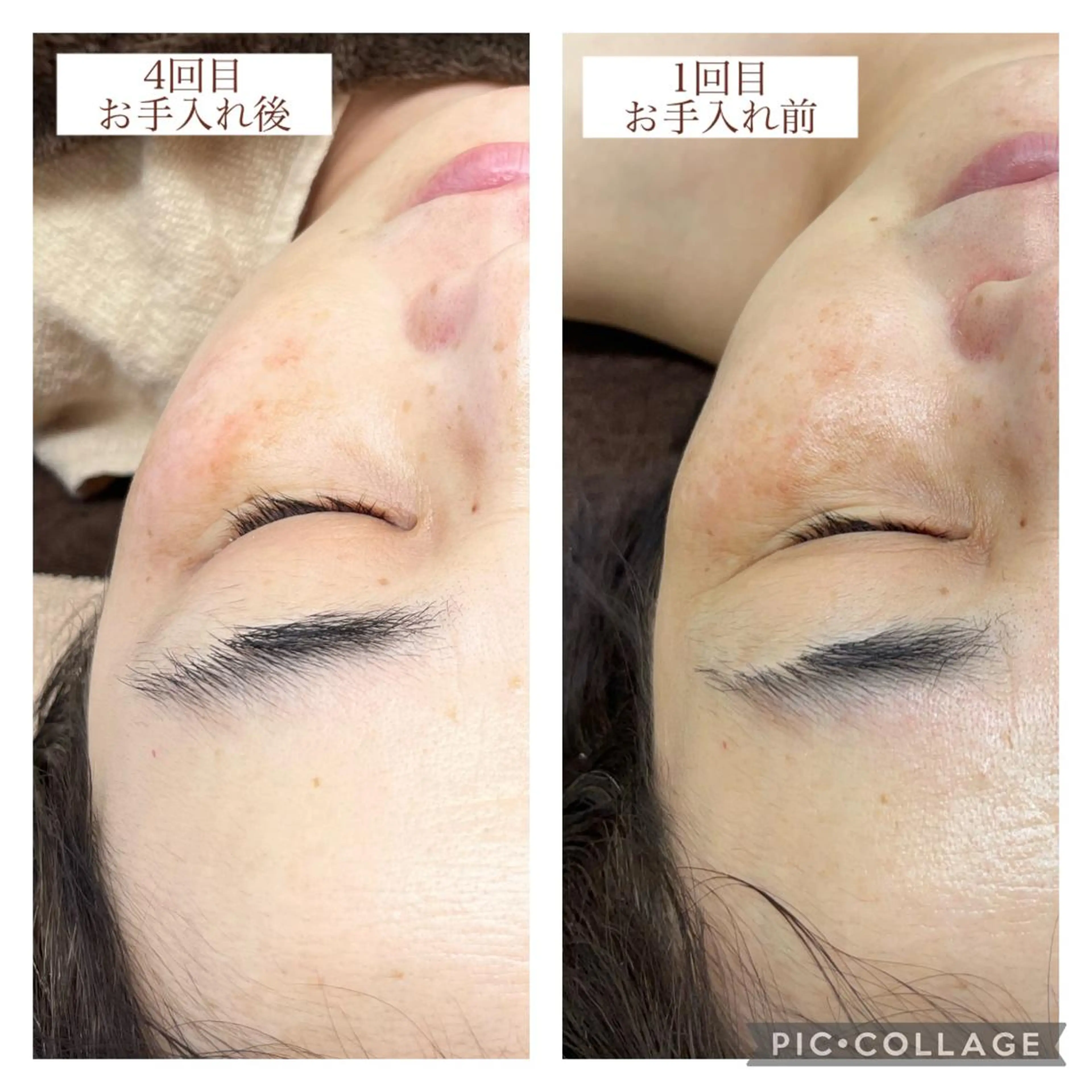 脱毛サロン+one 八王子のエステ・リラクイメージ