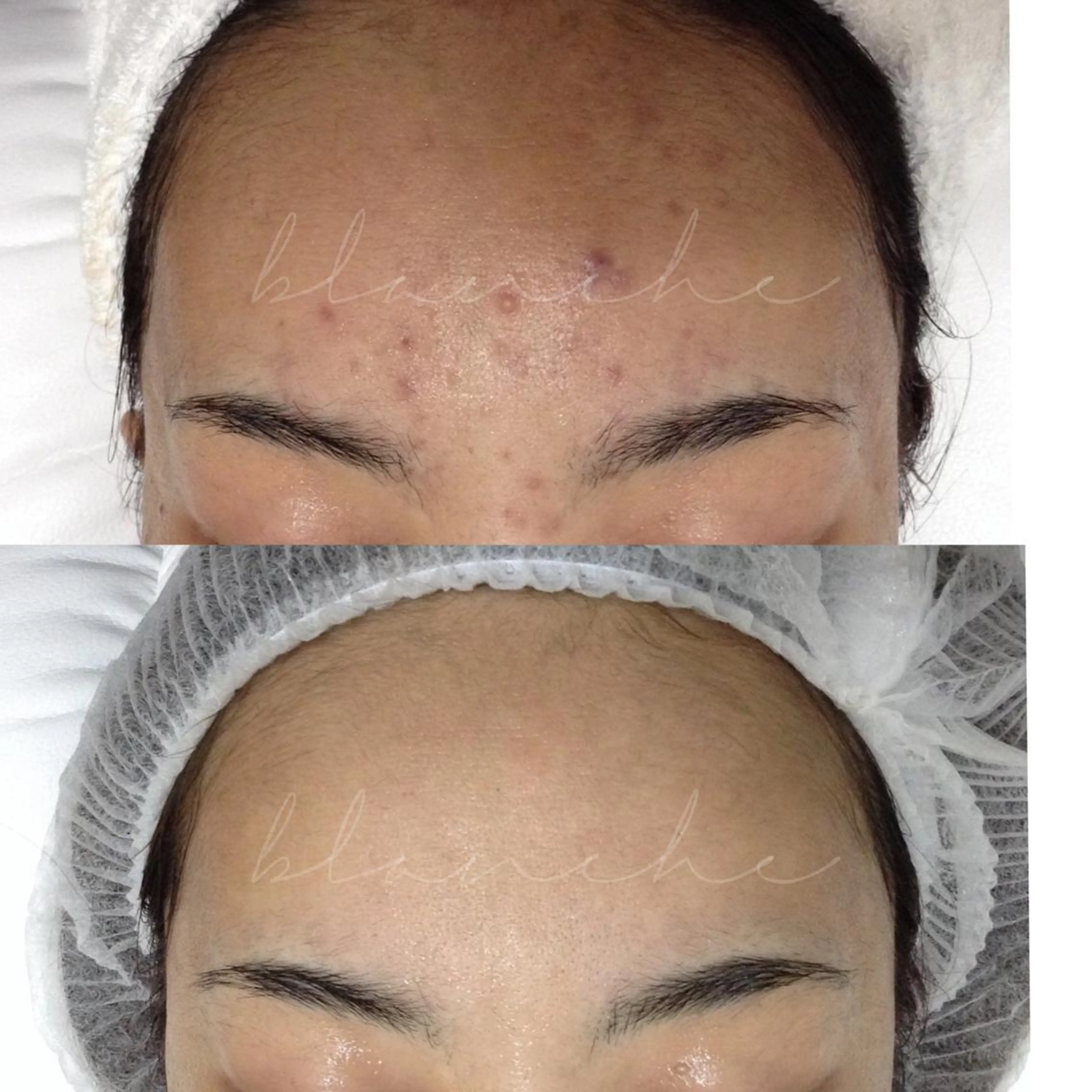 ロング カラー パーマ ヘアアレンジ ネイル マツエク・マツパ アイブロウ エステ リラク 都度払い肌質改善 &脱毛Blancheのエステ・リラクイメージ