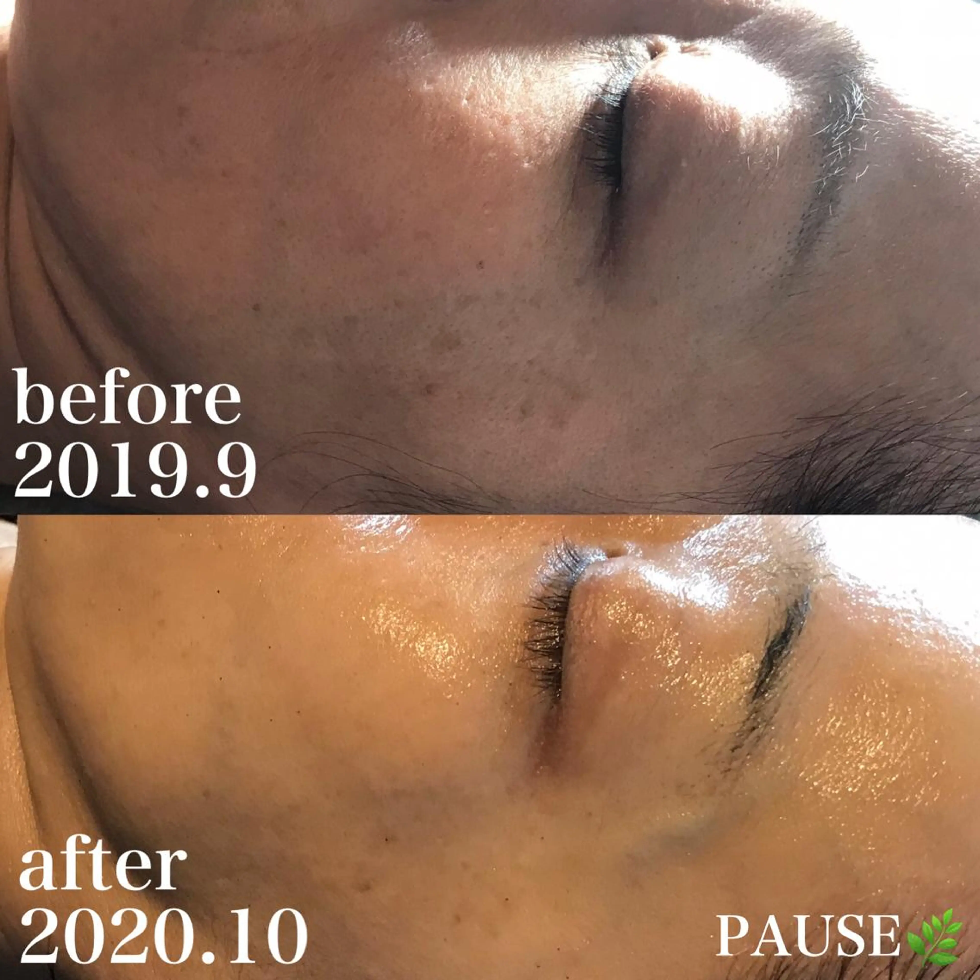 エステ 浜野 恵美のエステ・リラクイメージ