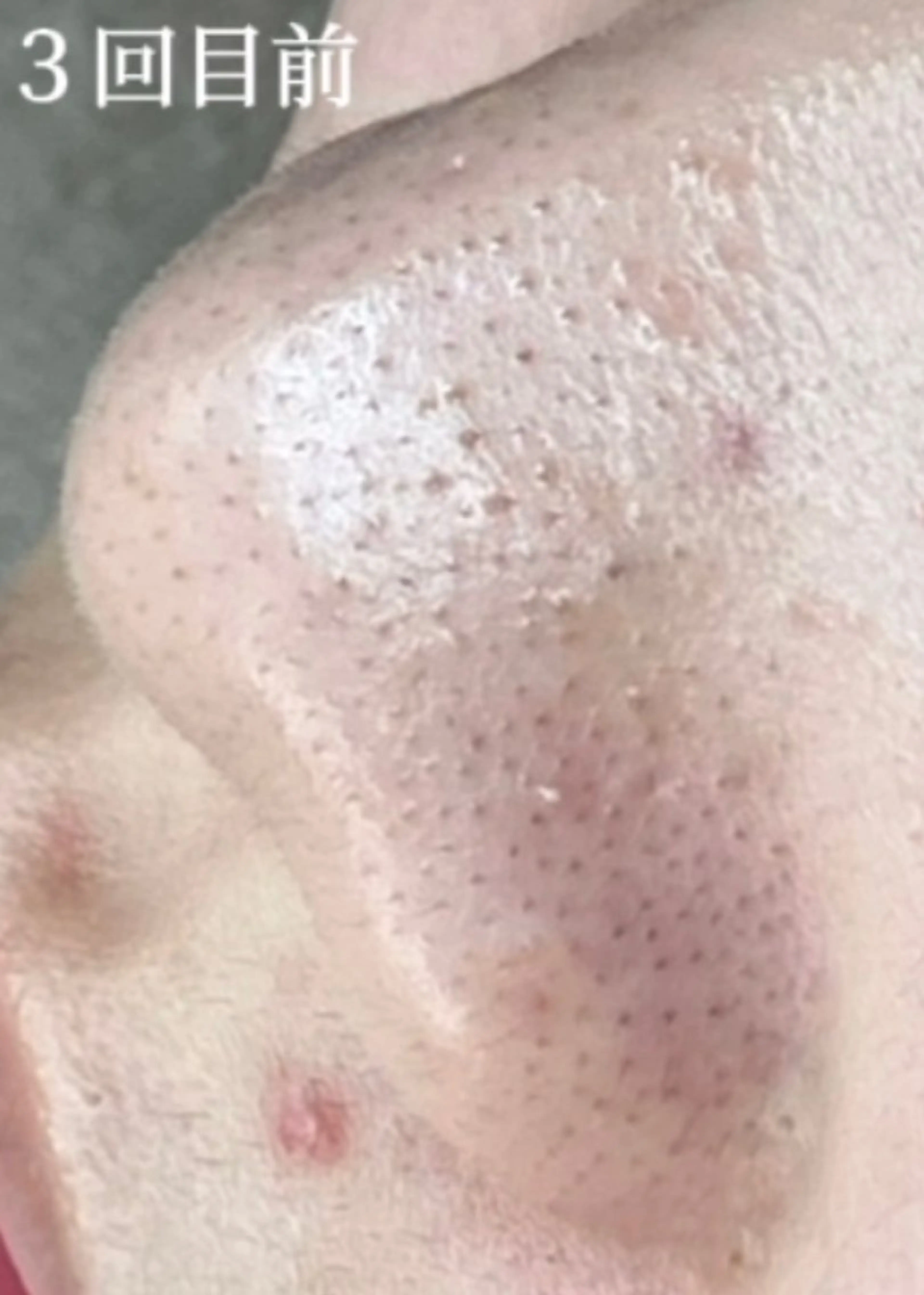 毛穴肌質ケアサロン Yourmeユアミーのエステ・リラクイメージ