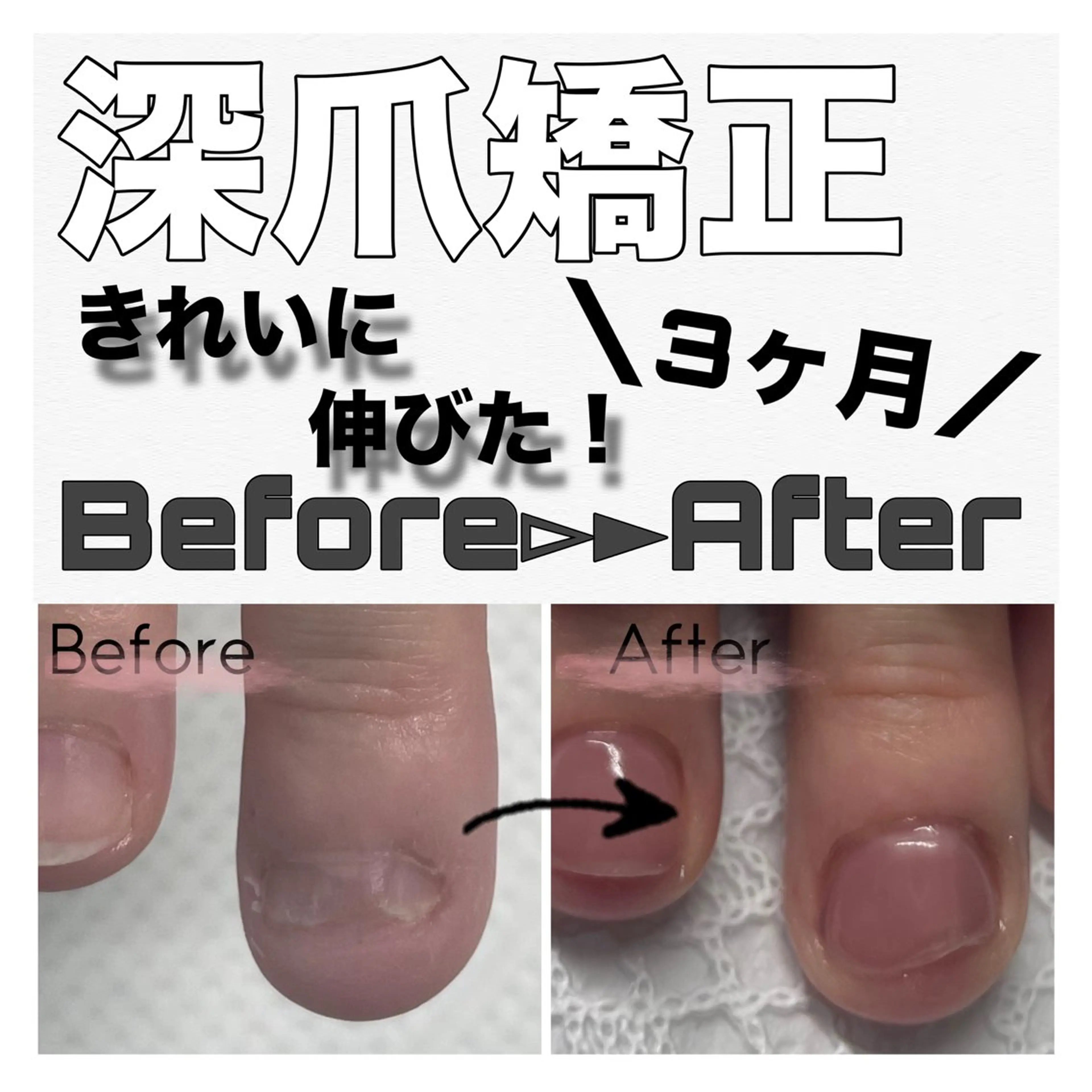 ネイル アートネイル クリアネイル ジェルネイル ピンク nail salon petillantのネイルデザイン