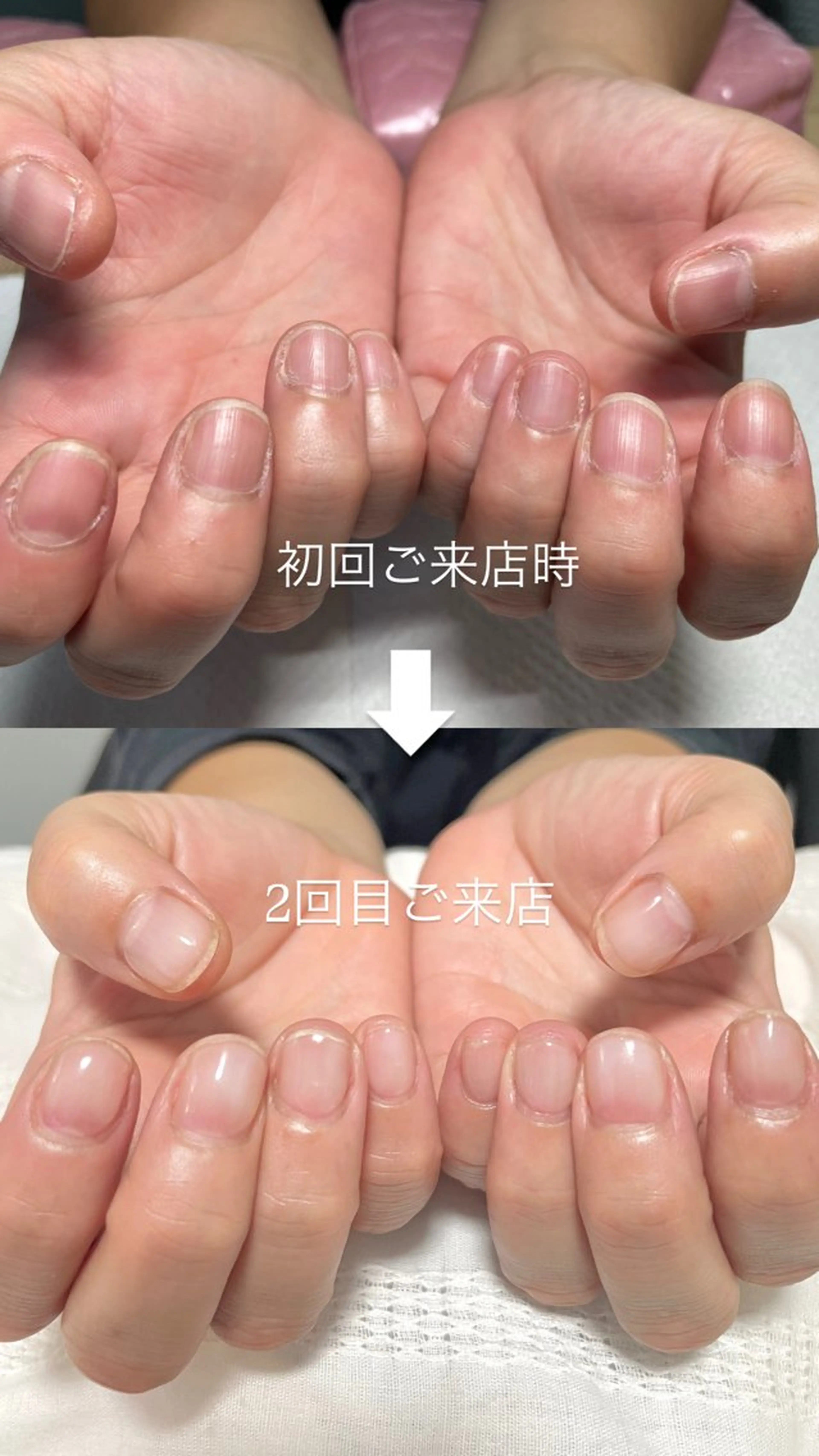 美爪になれる♡自爪育成コースの写真