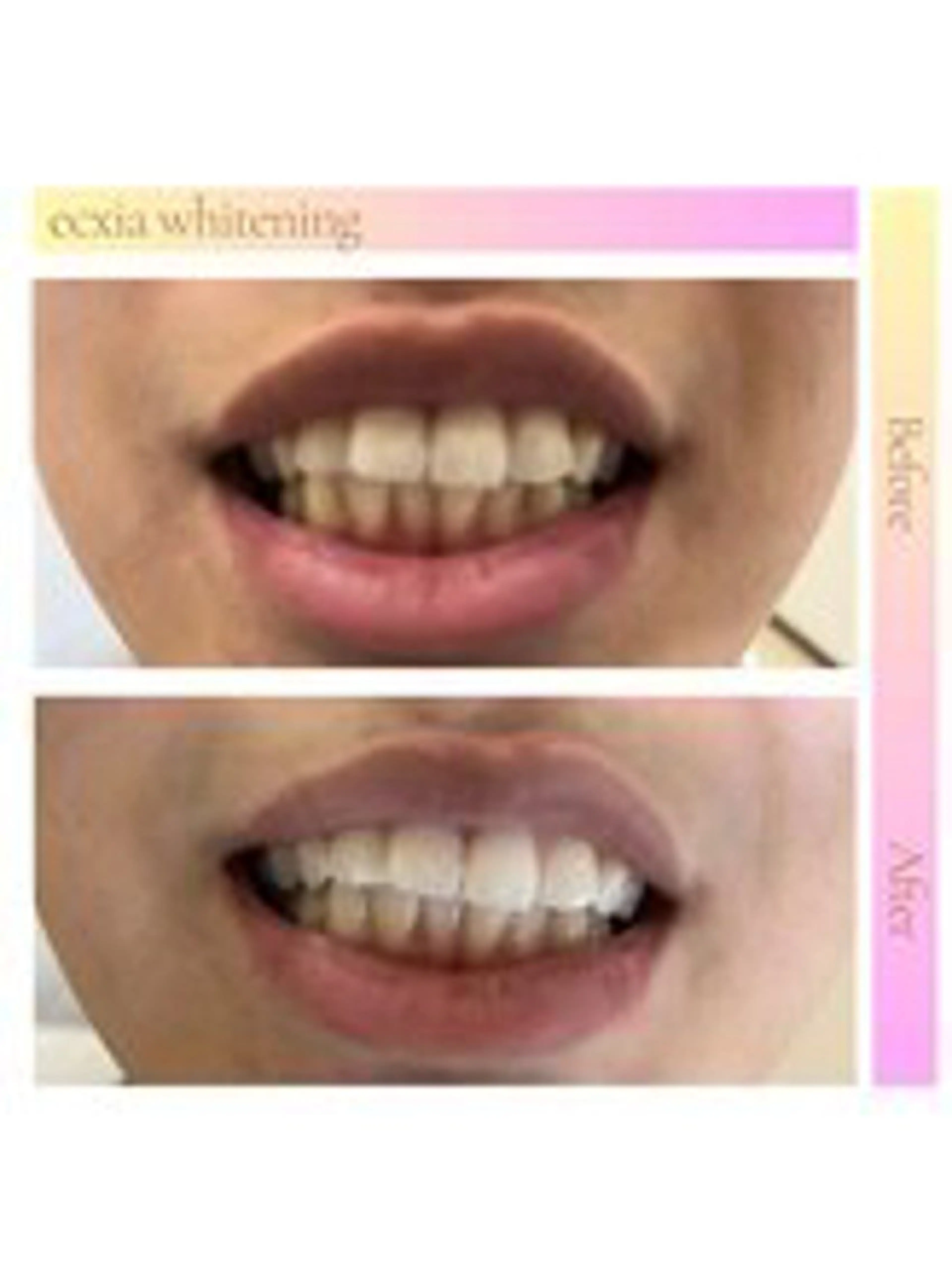 セルフホワイトニング エクシア西宮北口店のその他イメージ