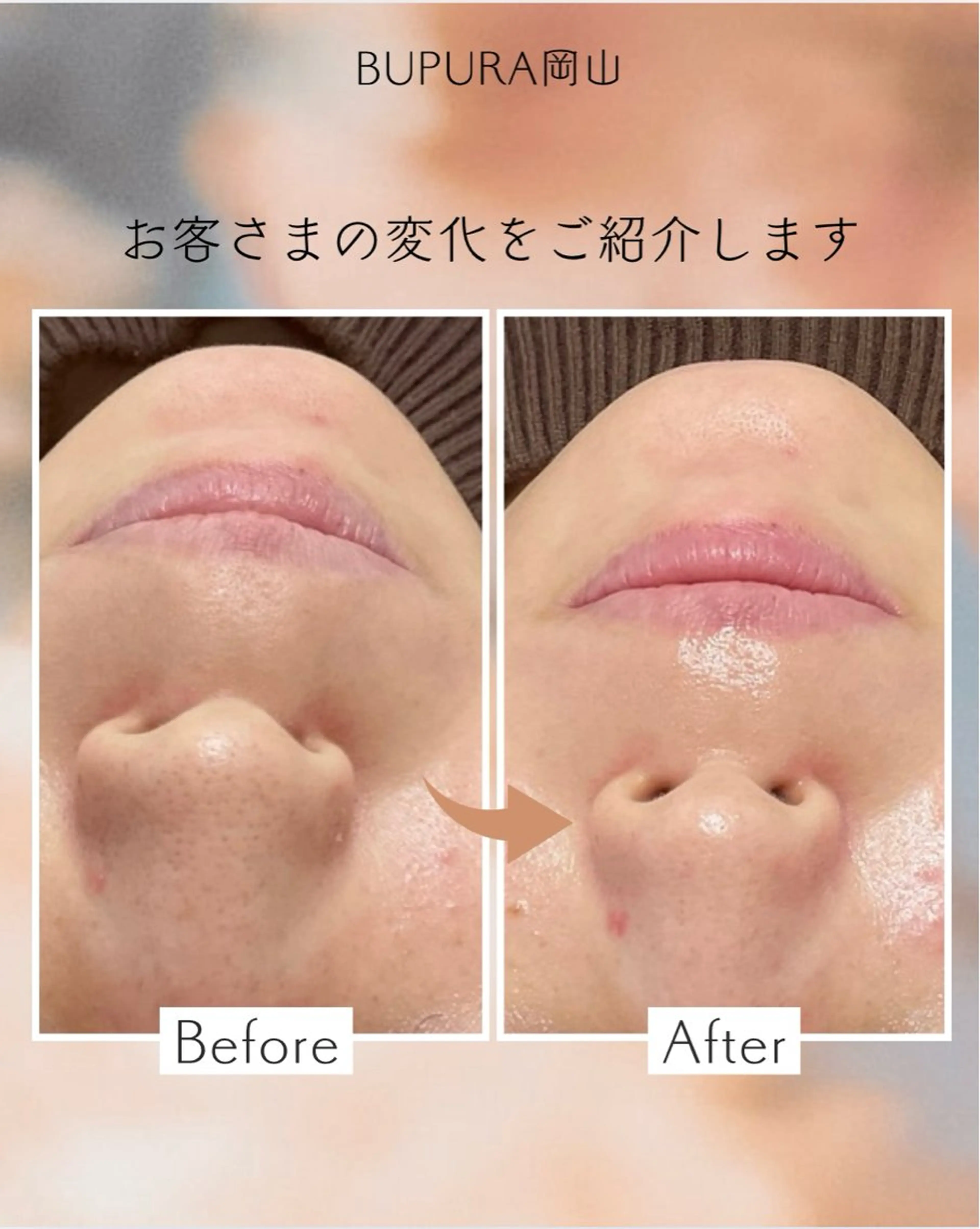 小顔矯正＆肌質改善 BUPURA岡山のエステ・リラクイメージ
