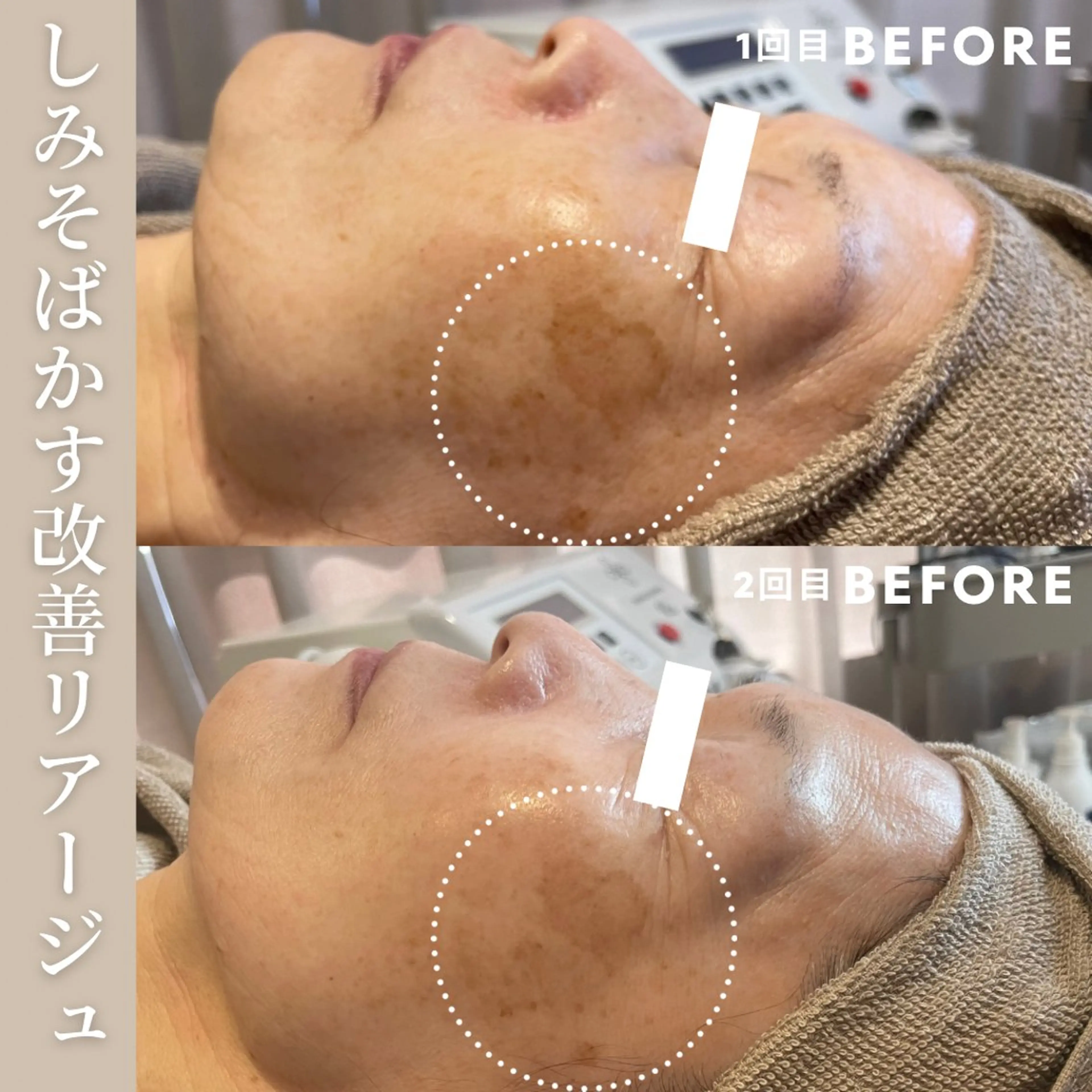 エステ Lassy Yuriの眉毛・アイブロウイメージ