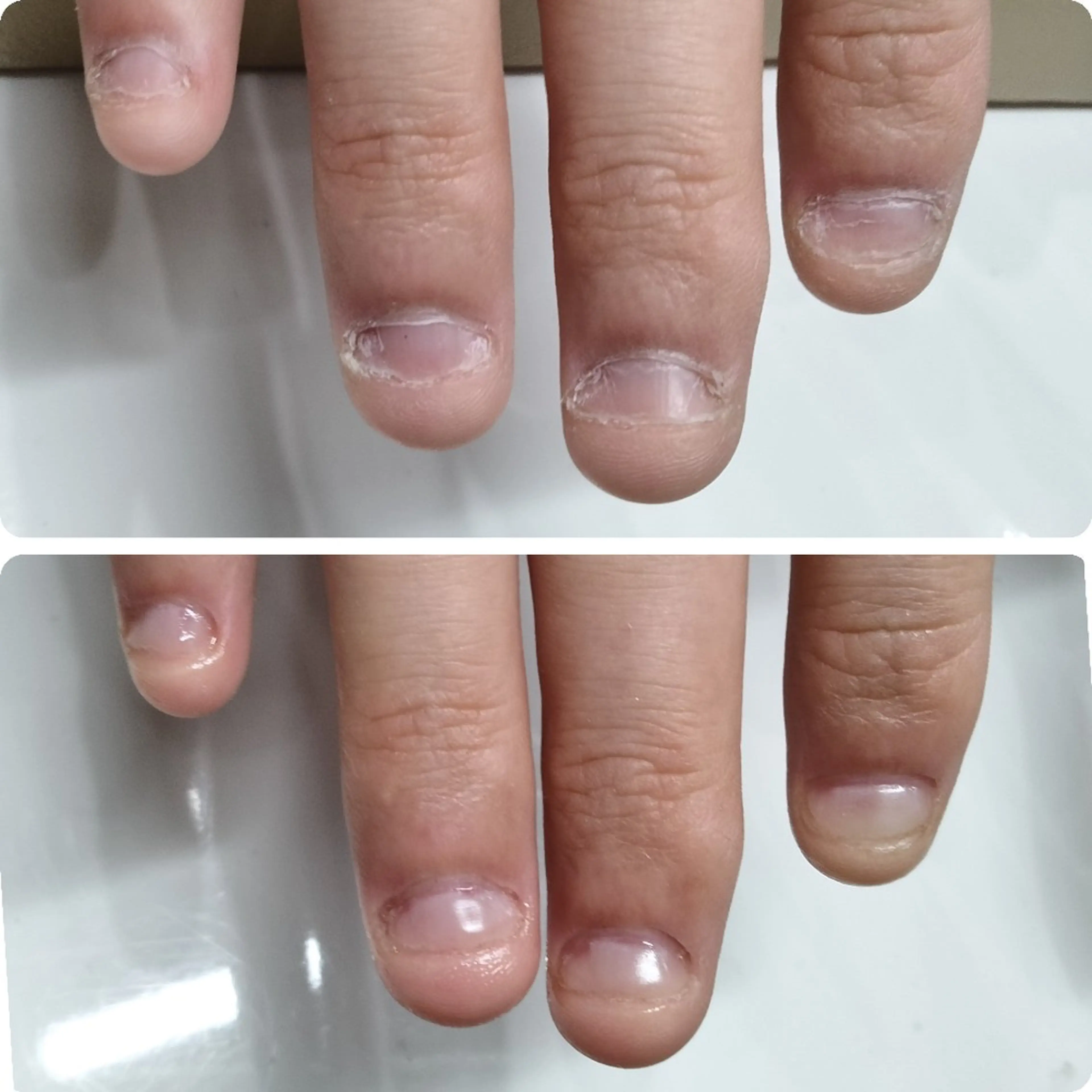 目立たず自然な自爪風✨【深爪補正｜自爪育成クリア（マットも可）】の写真