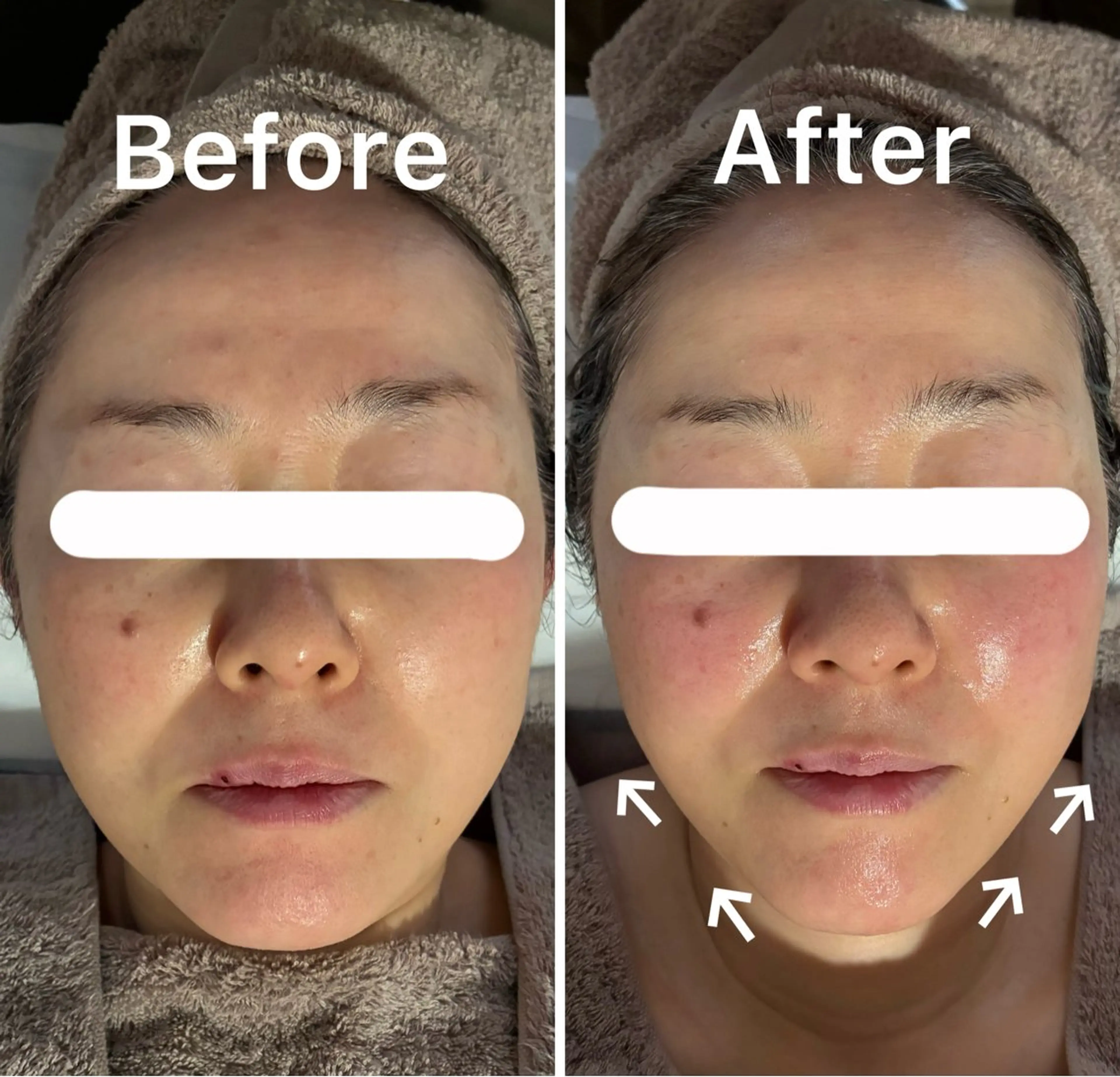 CHERIE Akaneのエステ・リラクイメージ