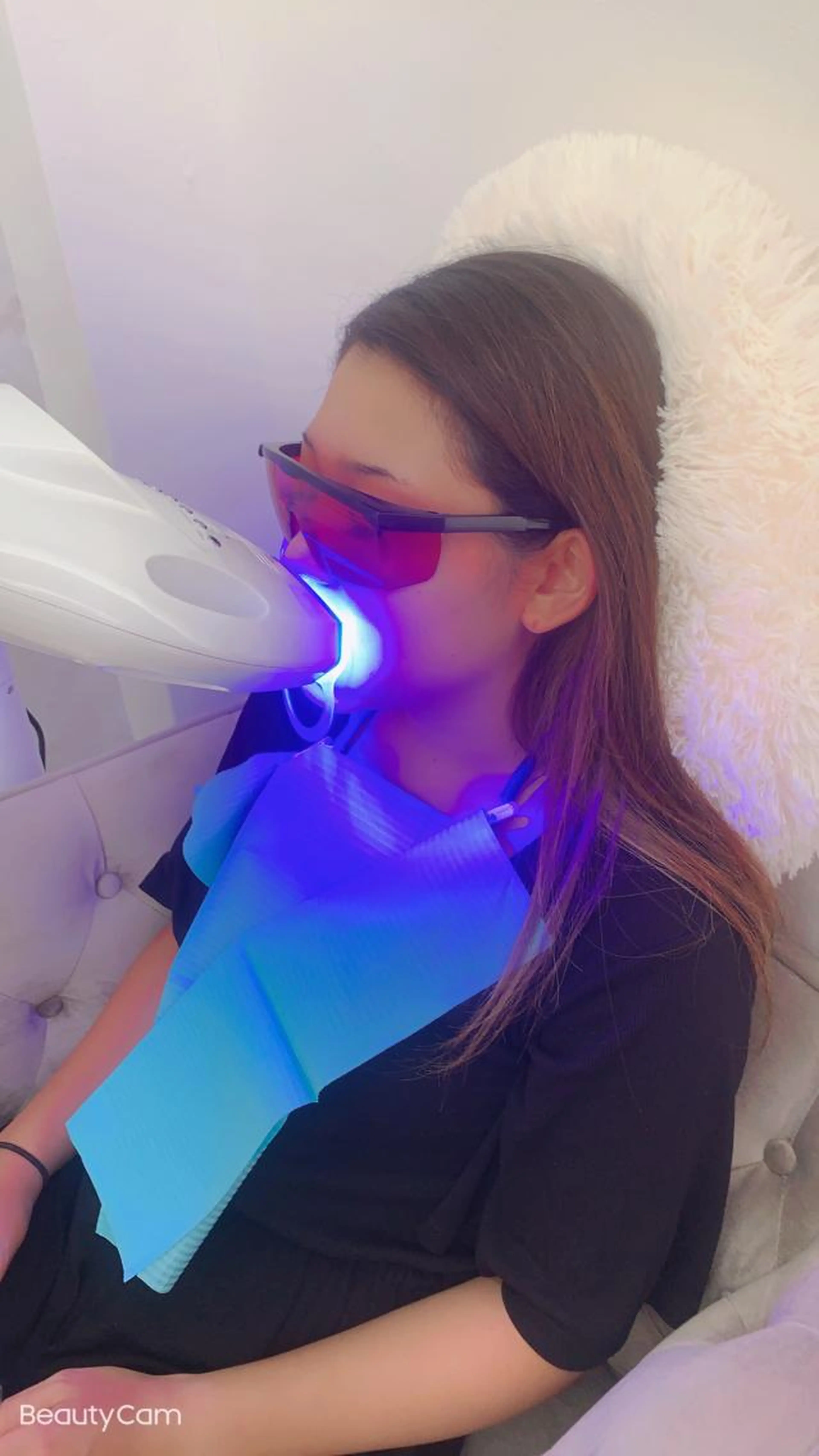 セルフホワイトニング🦷の写真