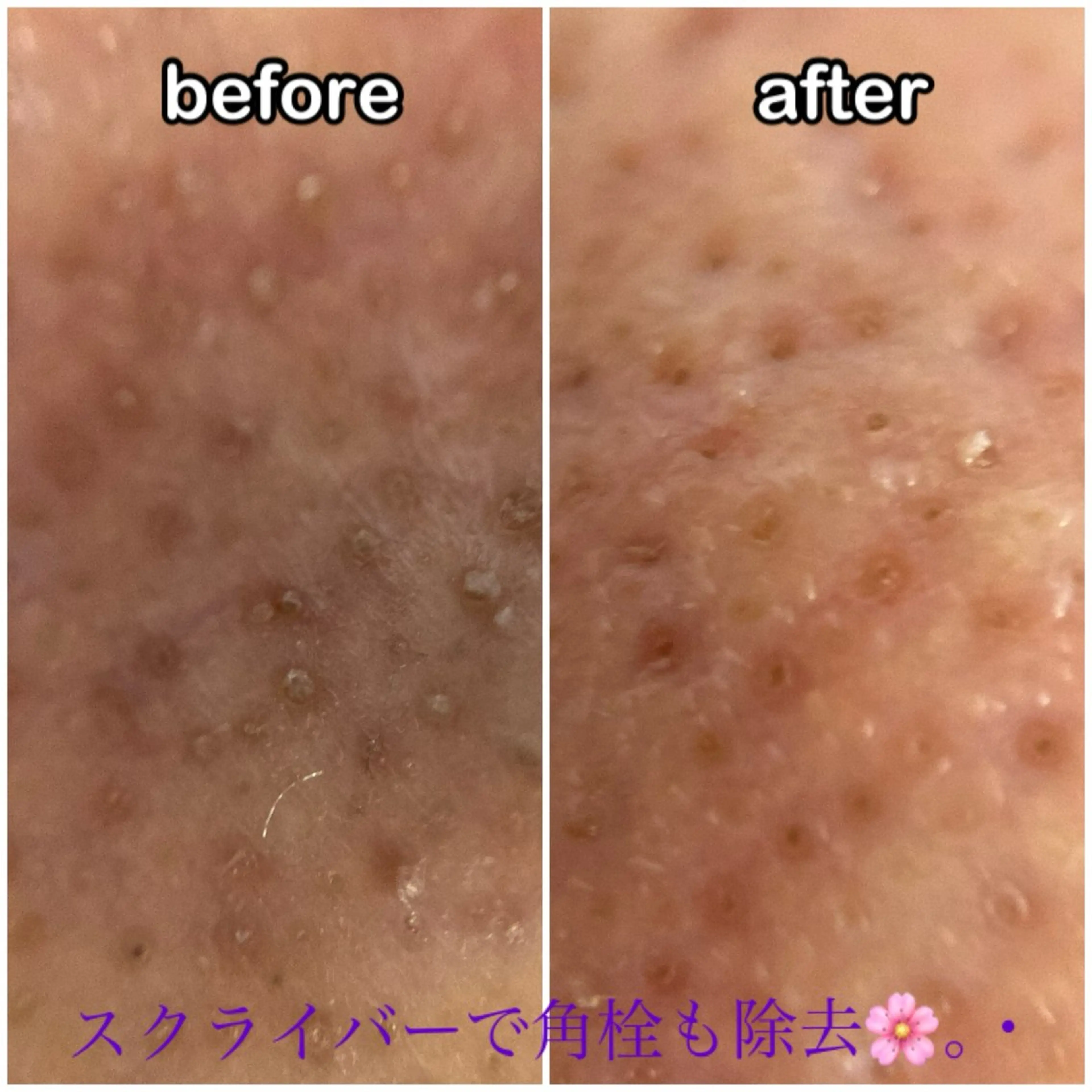 プレジール所属・ビューティサロン プレジールOTAKEのエステ・リラクイメージ