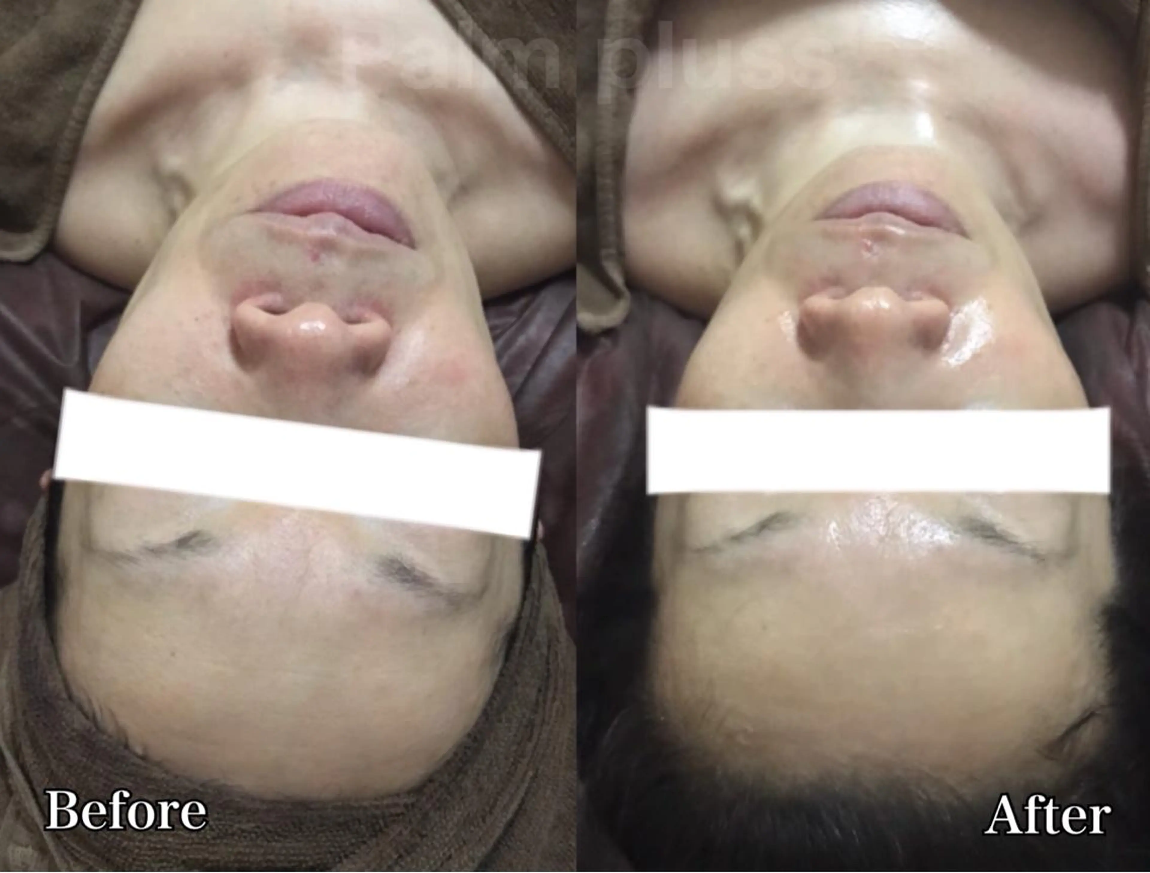 Kalnicco (カルニッコ)のエステ・リラクイメージ