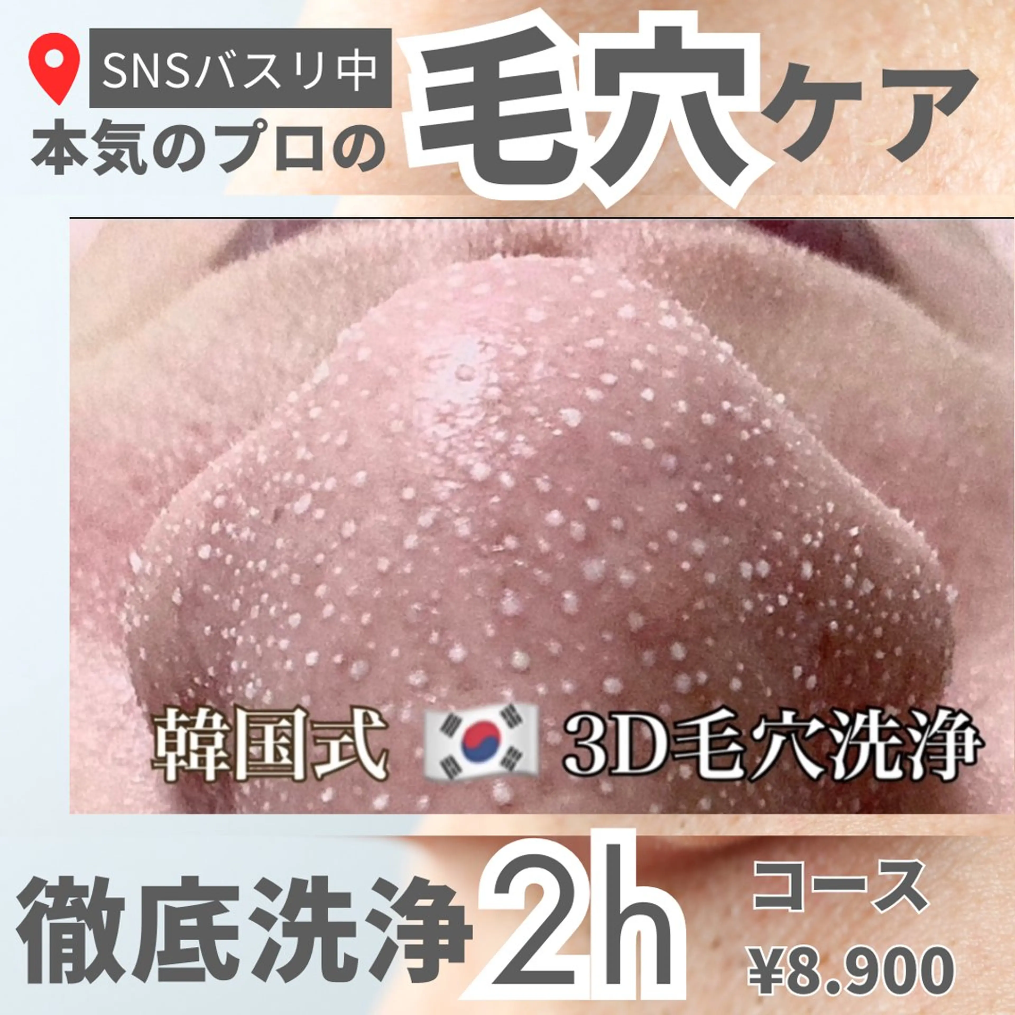 ◆韓国式3D毛穴洗浄（全顔）¥17900→¥8900🇰🇷SNSでバズリ中‼️（男性／女性／どなた様でも♪）の写真