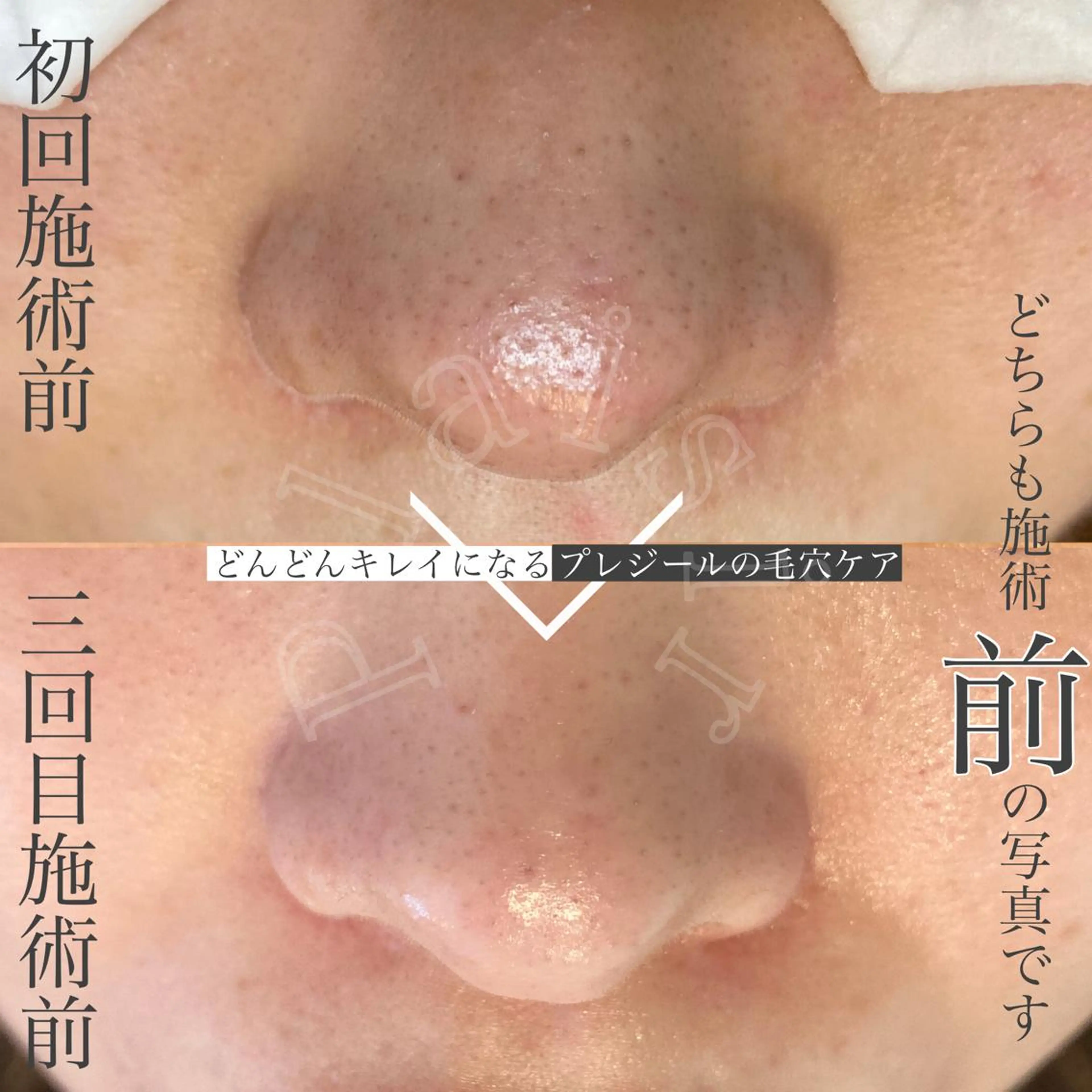 eyelashsalon Plaisir所属・ツカハラ ミカのエステ・リラクイメージ