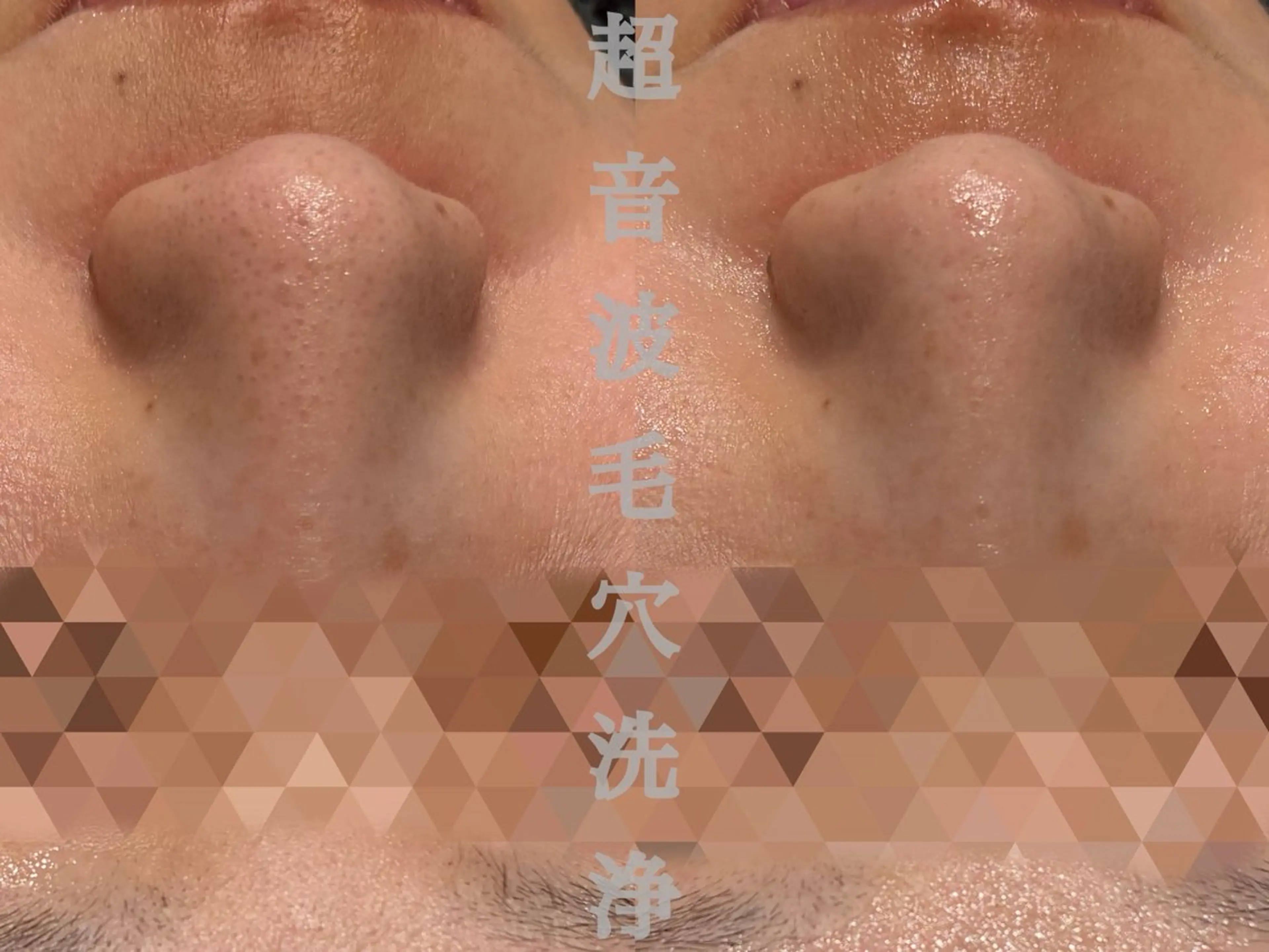 その他 Esthetic ReTweetのエステ・リラクイメージ