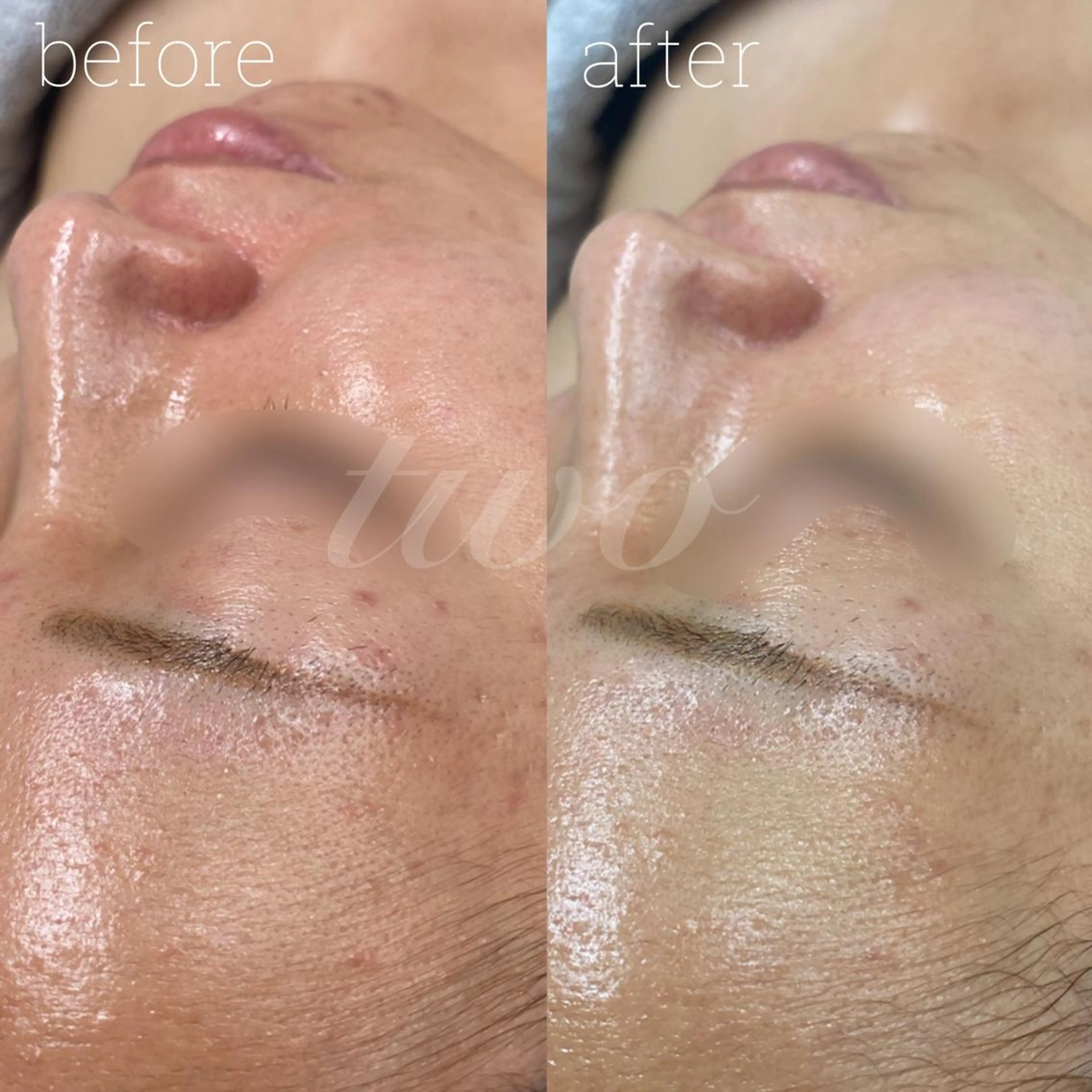 マツエク・マツパ エステ 《心斎橋》 twoのエステ・リラクイメージ