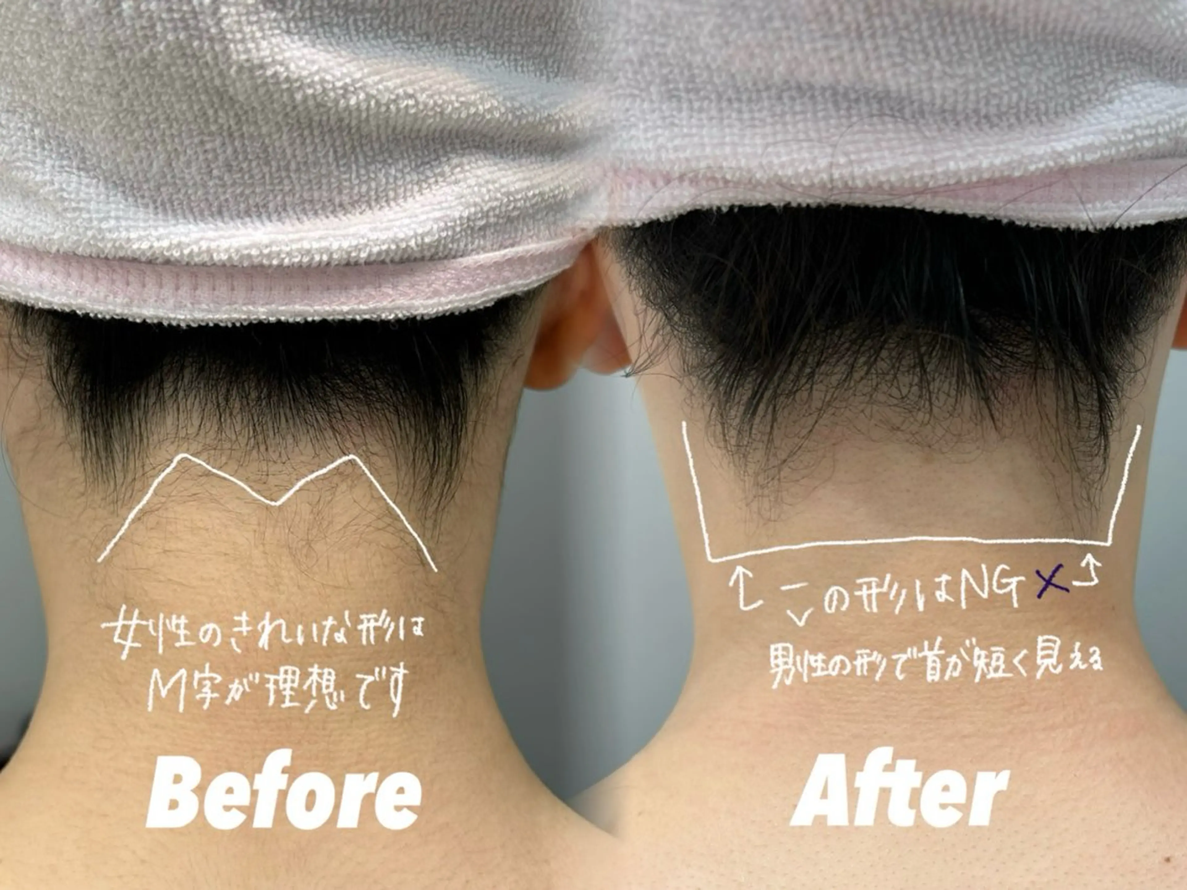 その他 🫧美しい素肌へ🫧 今成柚乃のその他イメージ