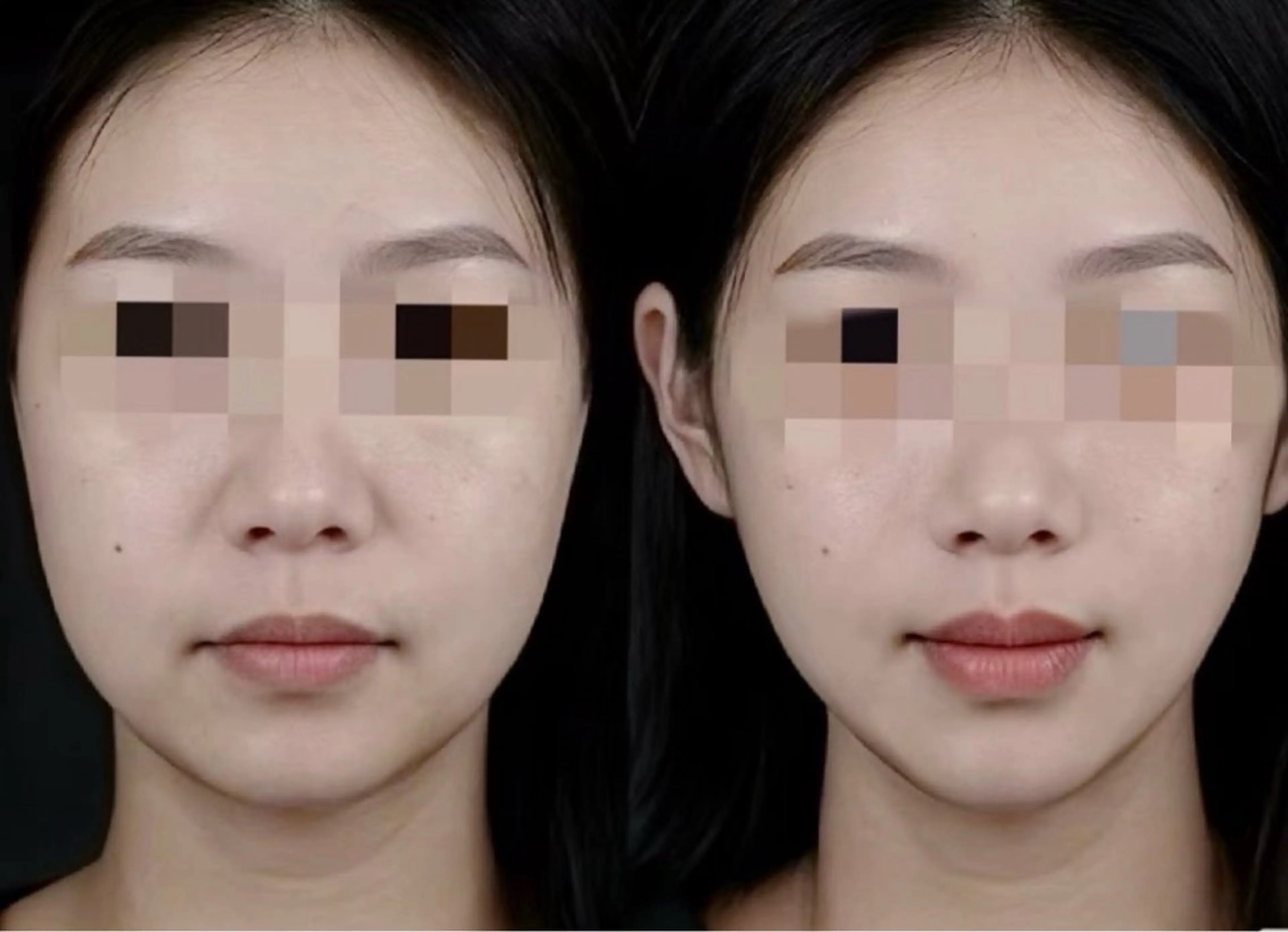 マツエク・マツパ エステ リラク 愛維美水光美肌専門店 メンズレディースokのエステ・リラクイメージ