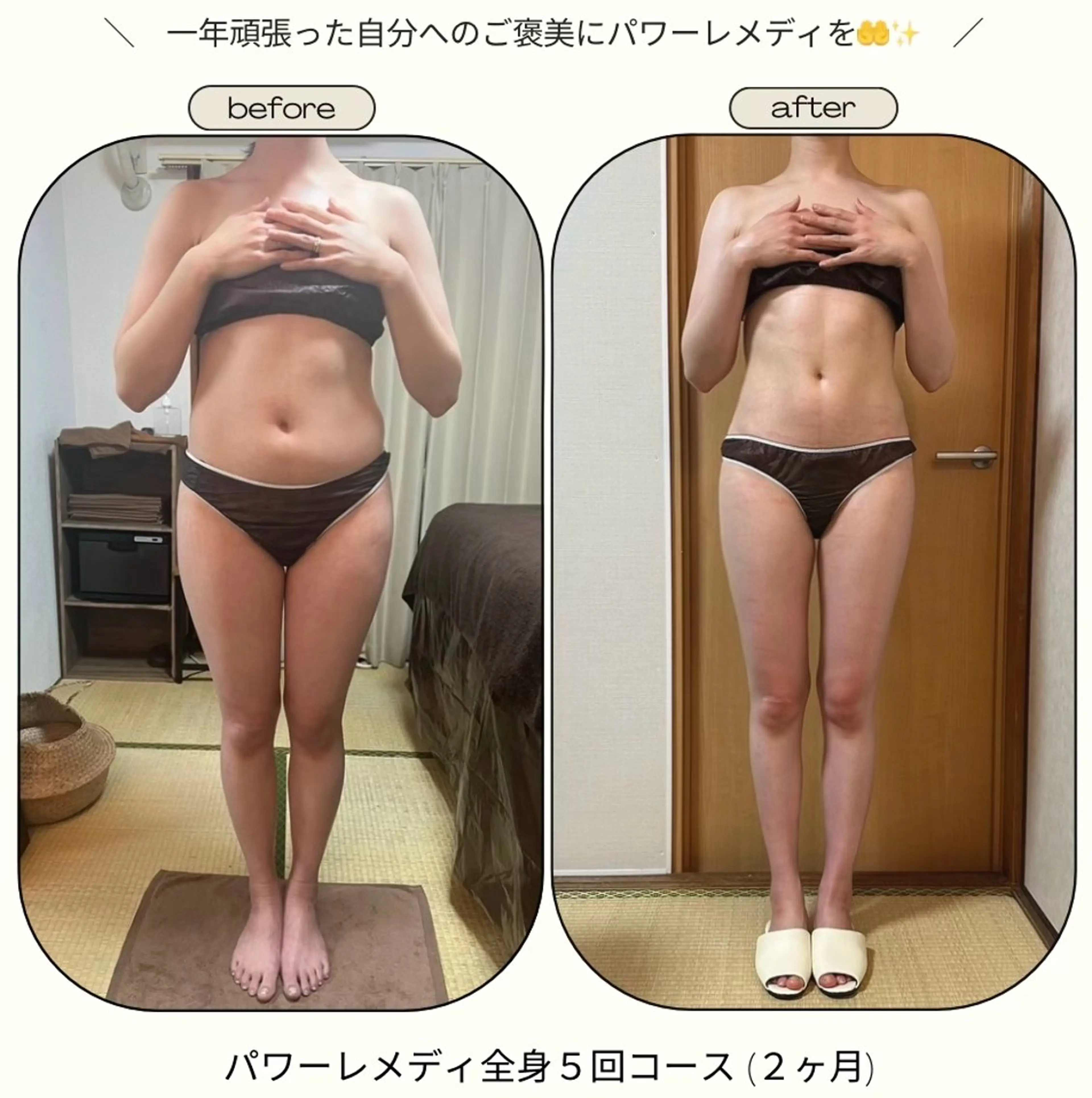 《本気痩せ×疲労改善 》  BILOOPのエステ・リラクイメージ