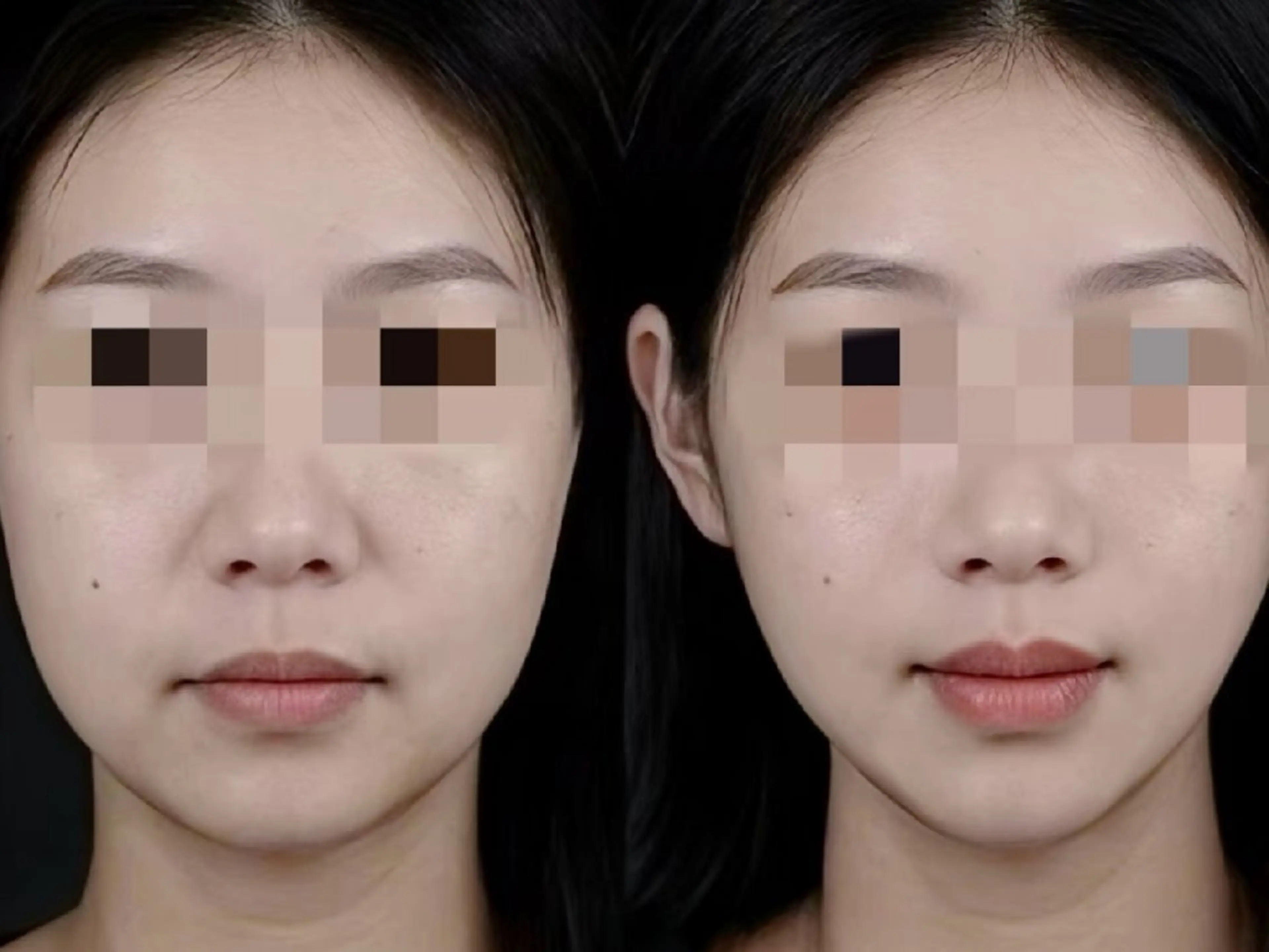 エステ aliaハーブ水光店 エステティシャン募集のエステ・リラクイメージ