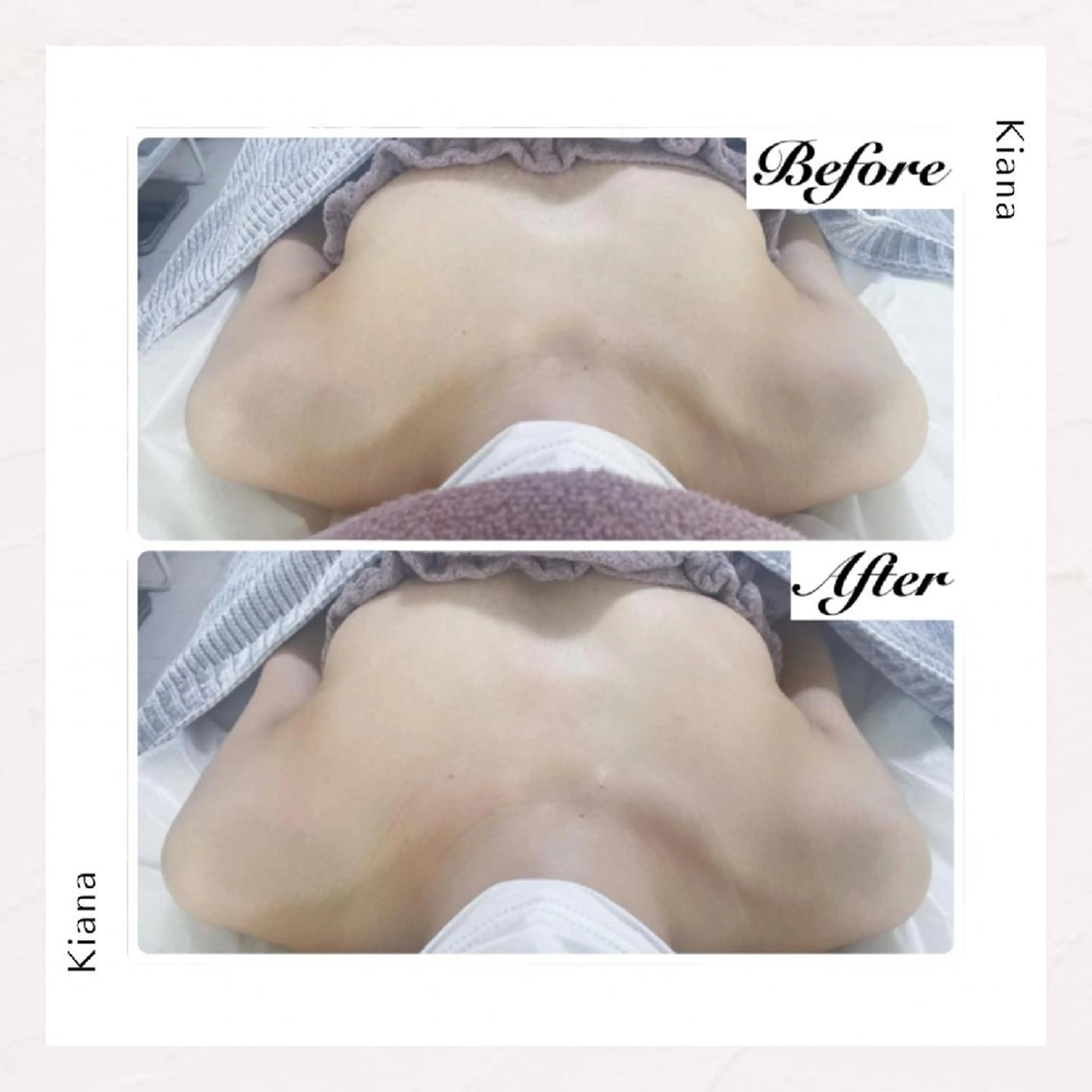 エステ リラク 【バスト専門店 】 Kiana のエステ・リラクイメージ