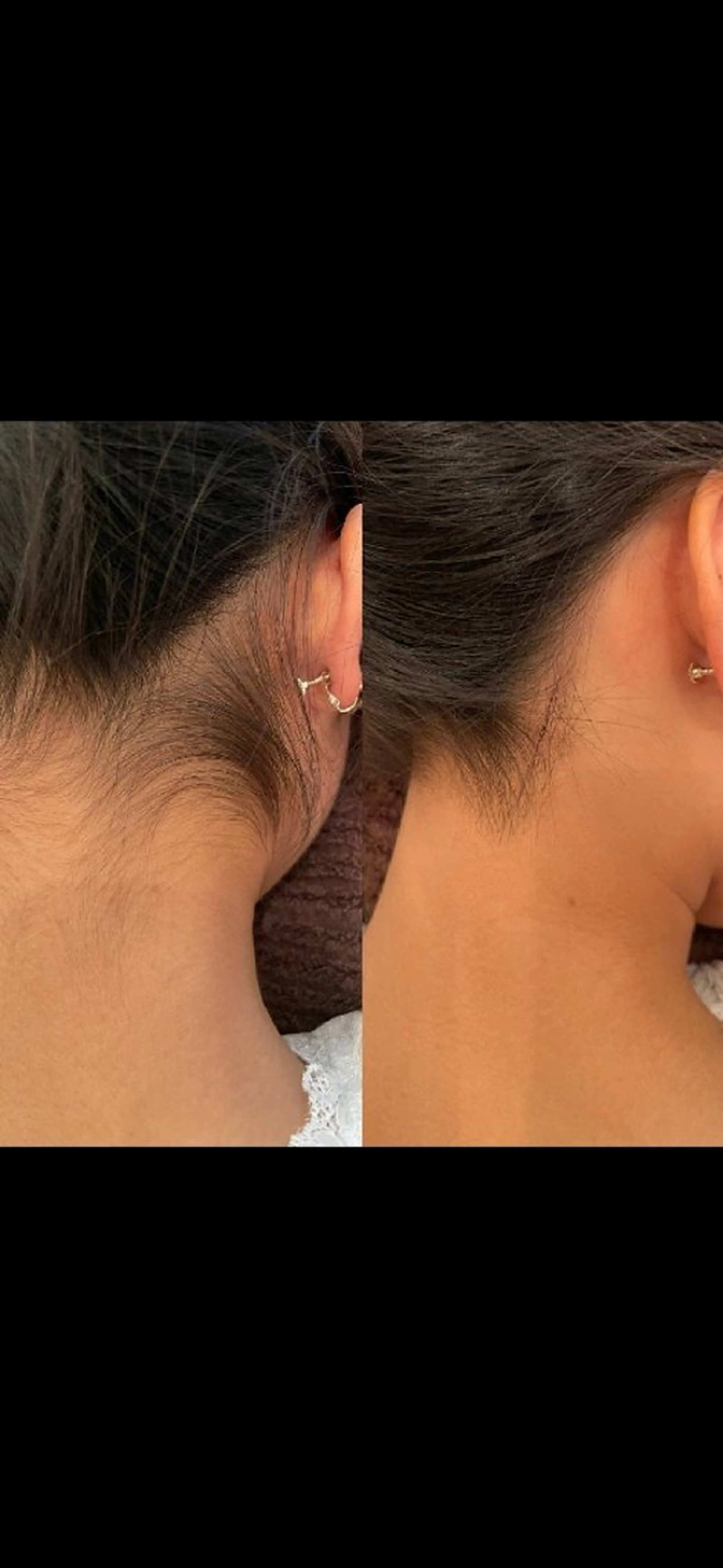 LOUISE. ／脱毛のエステ・リラクイメージ