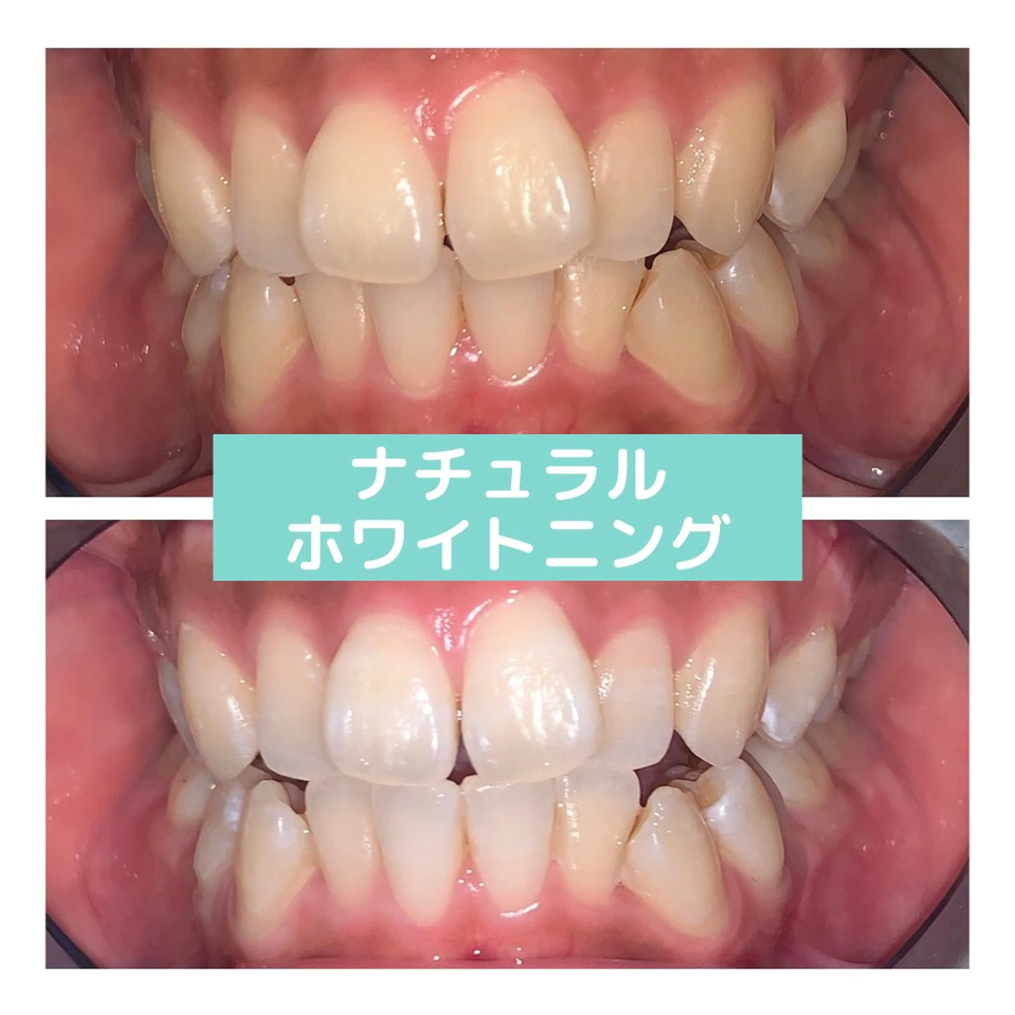 韓国式3D毛穴洗浄 lonhanaのその他イメージ