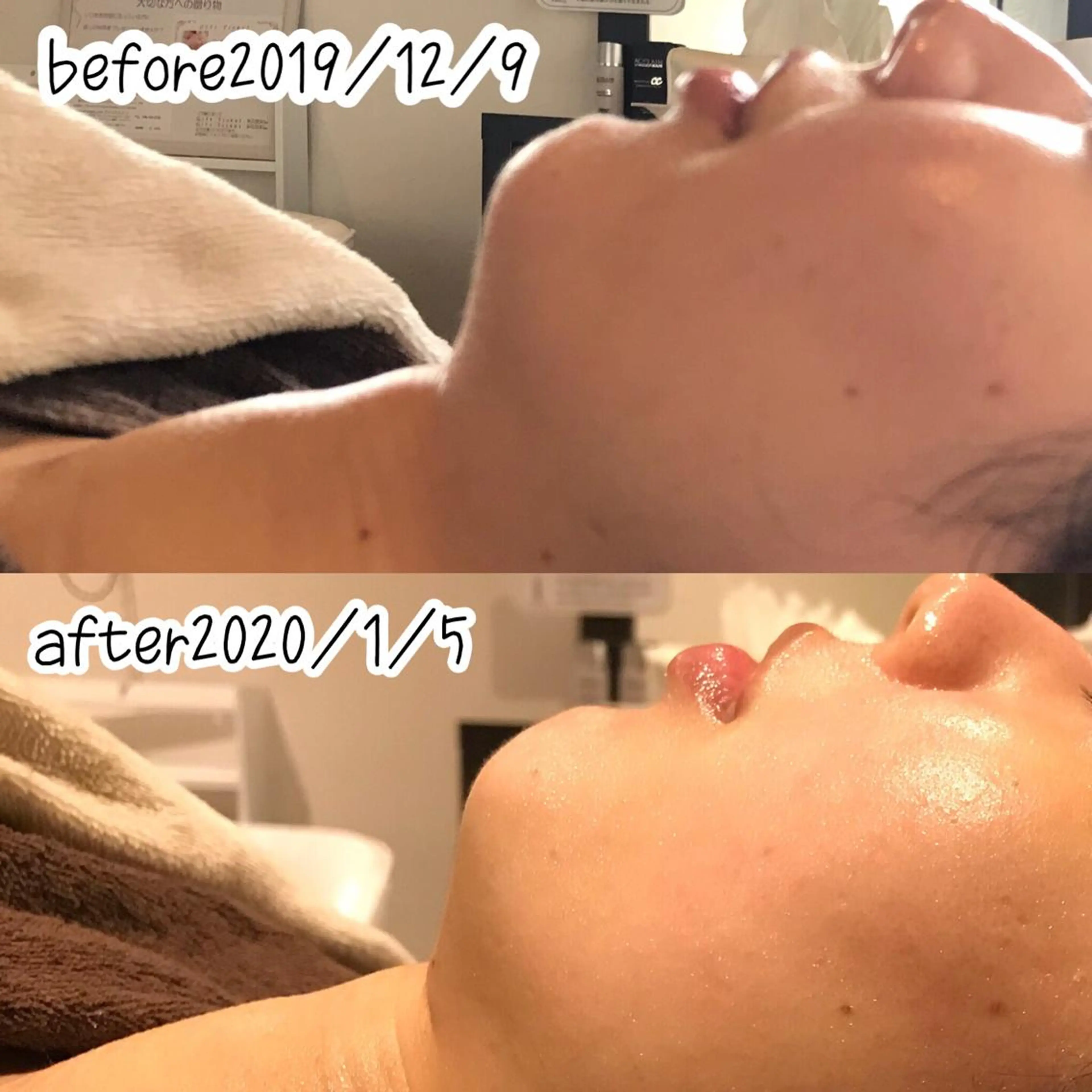 エステ 浜野 恵美のエステ・リラクイメージ