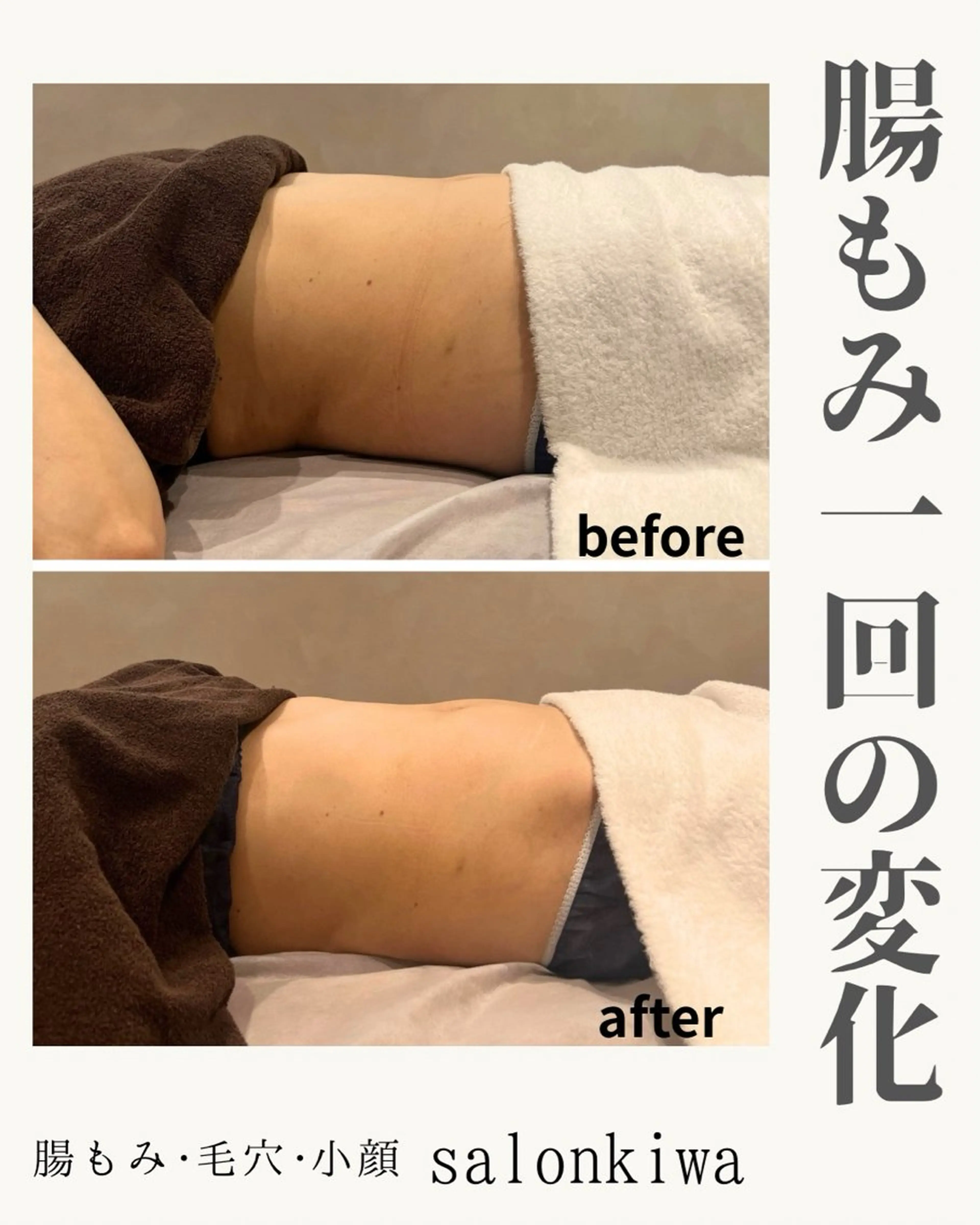 エステ 【毛穴&腸もみ】 salon kiwaのエステ・リラクイメージ