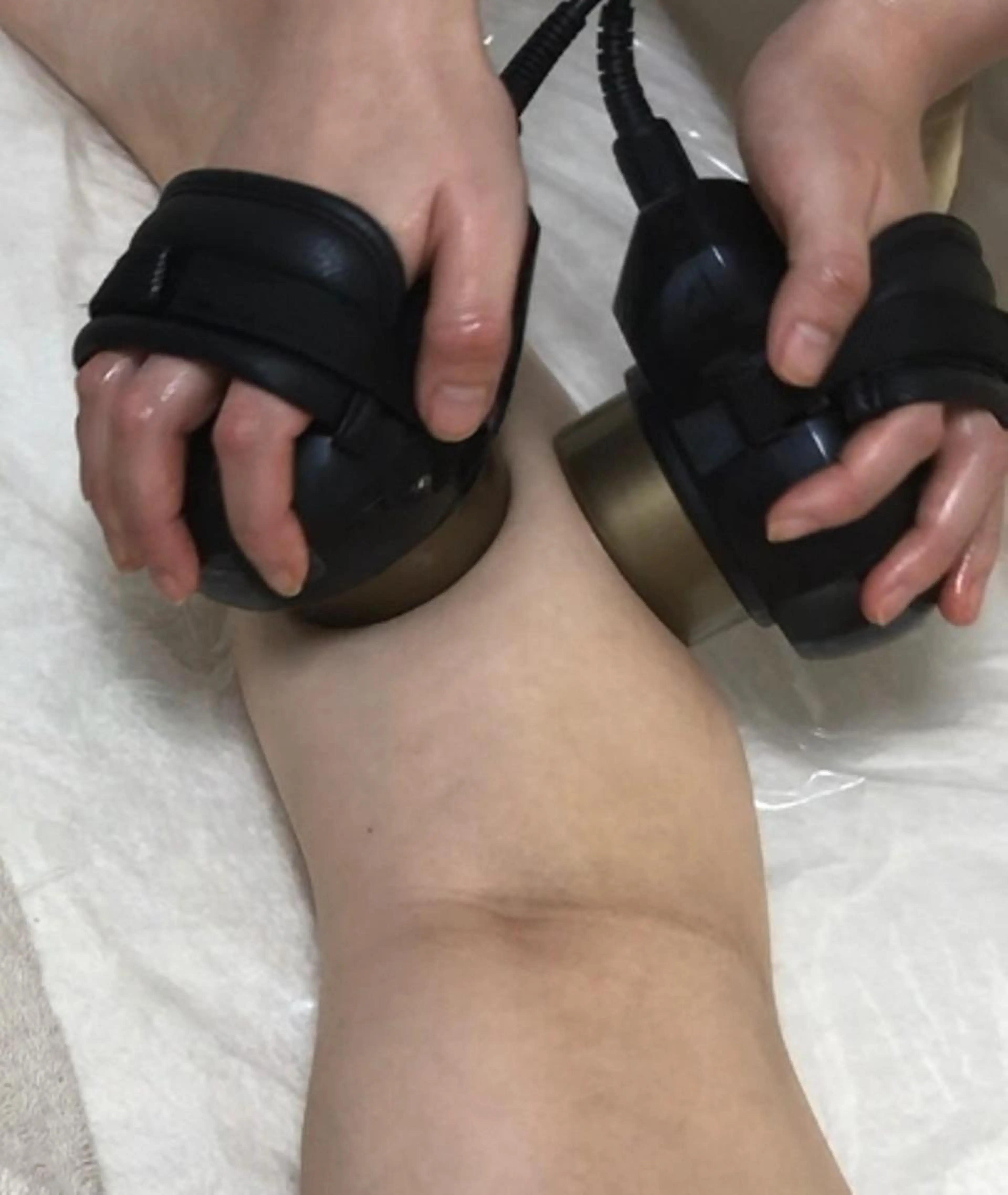 【メリハリボディ！】キャビスリム【部分ケア】おためし30分　背中/お腹/二の腕/ヒップ/ 太もも/ふくらはぎの写真