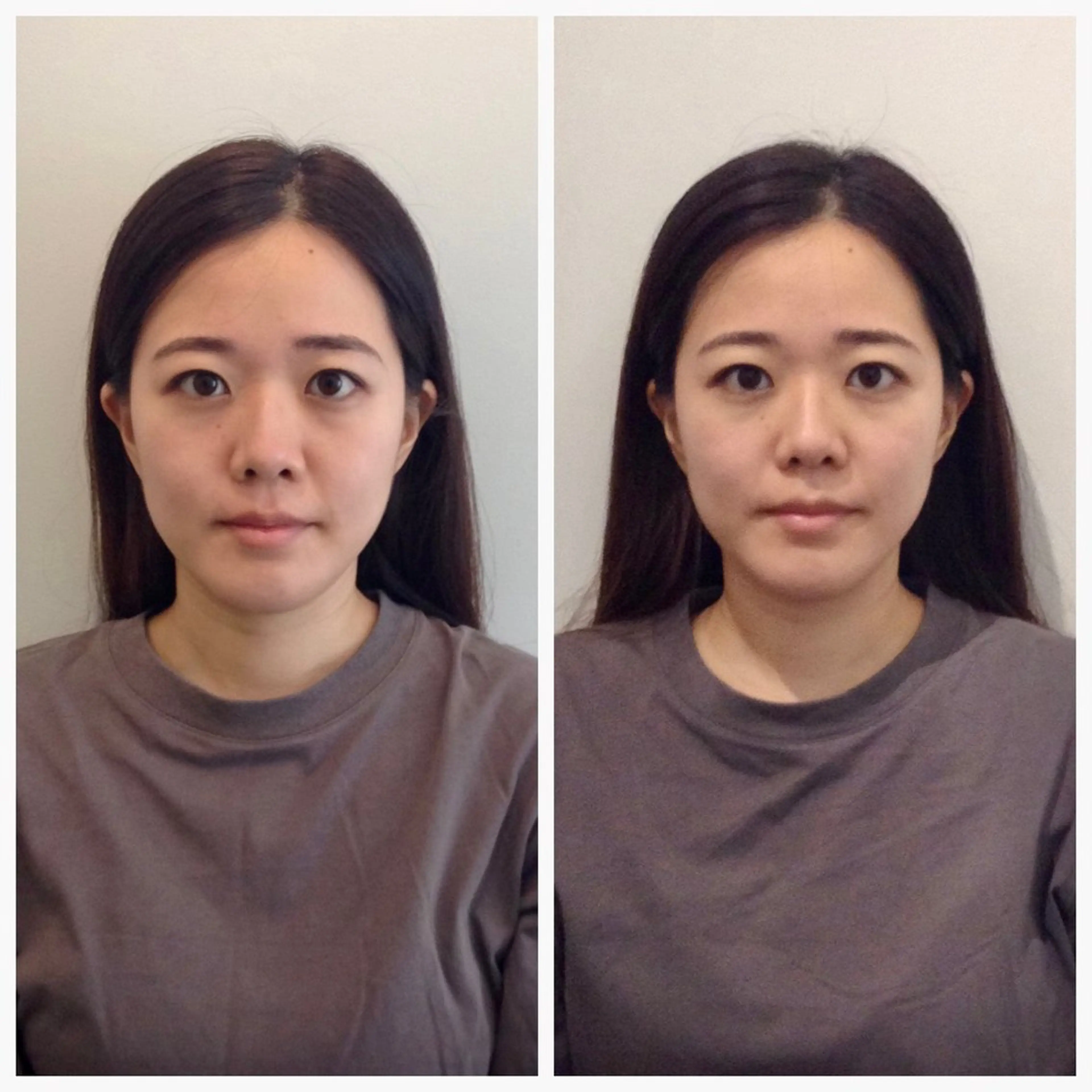 エステ リラク 美容整体 小顔矯正 プラスフィール荒木のエステ・リラクイメージ