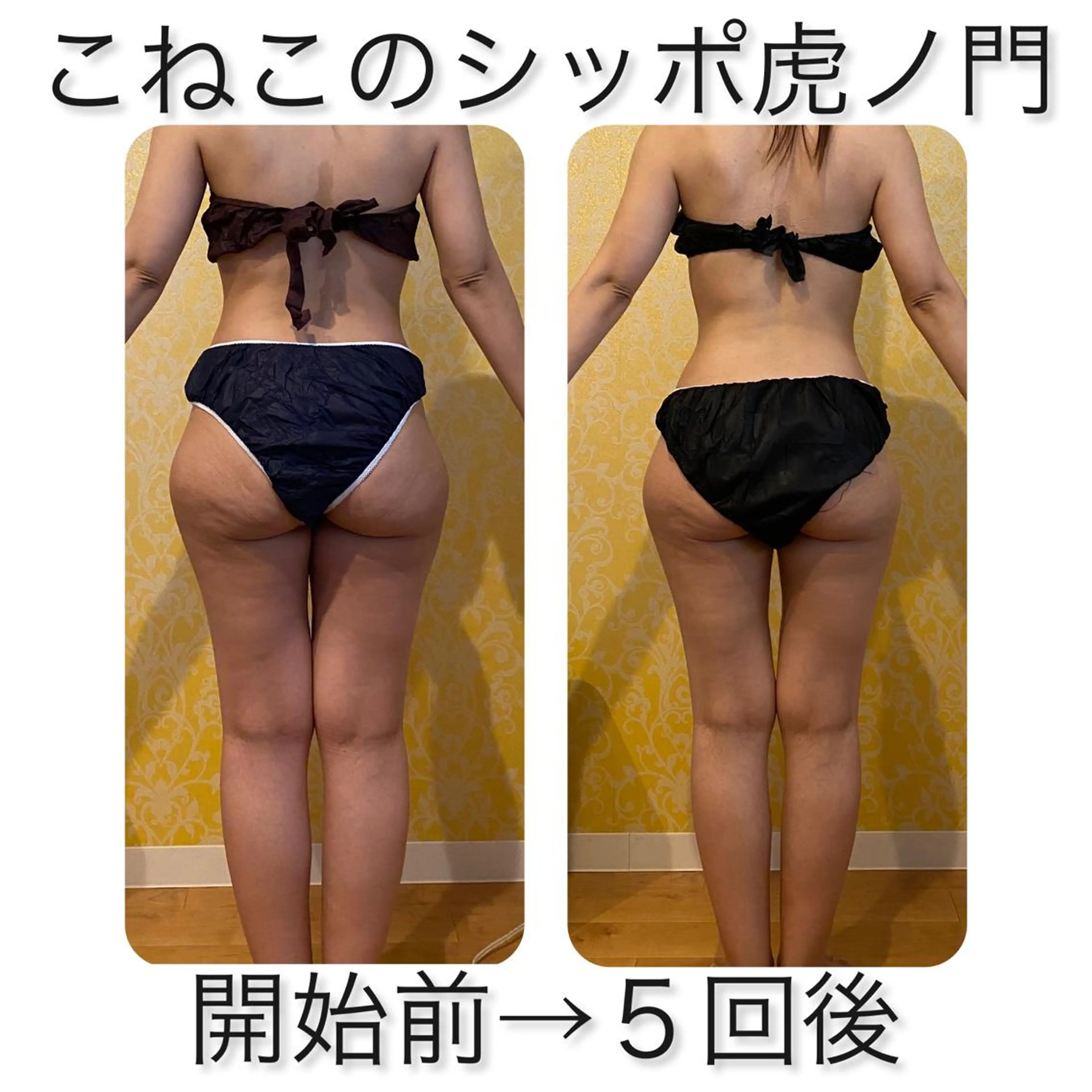 くびれ作り専門サロン こねこのシッポ虎ノ門のエステ・リラクイメージ