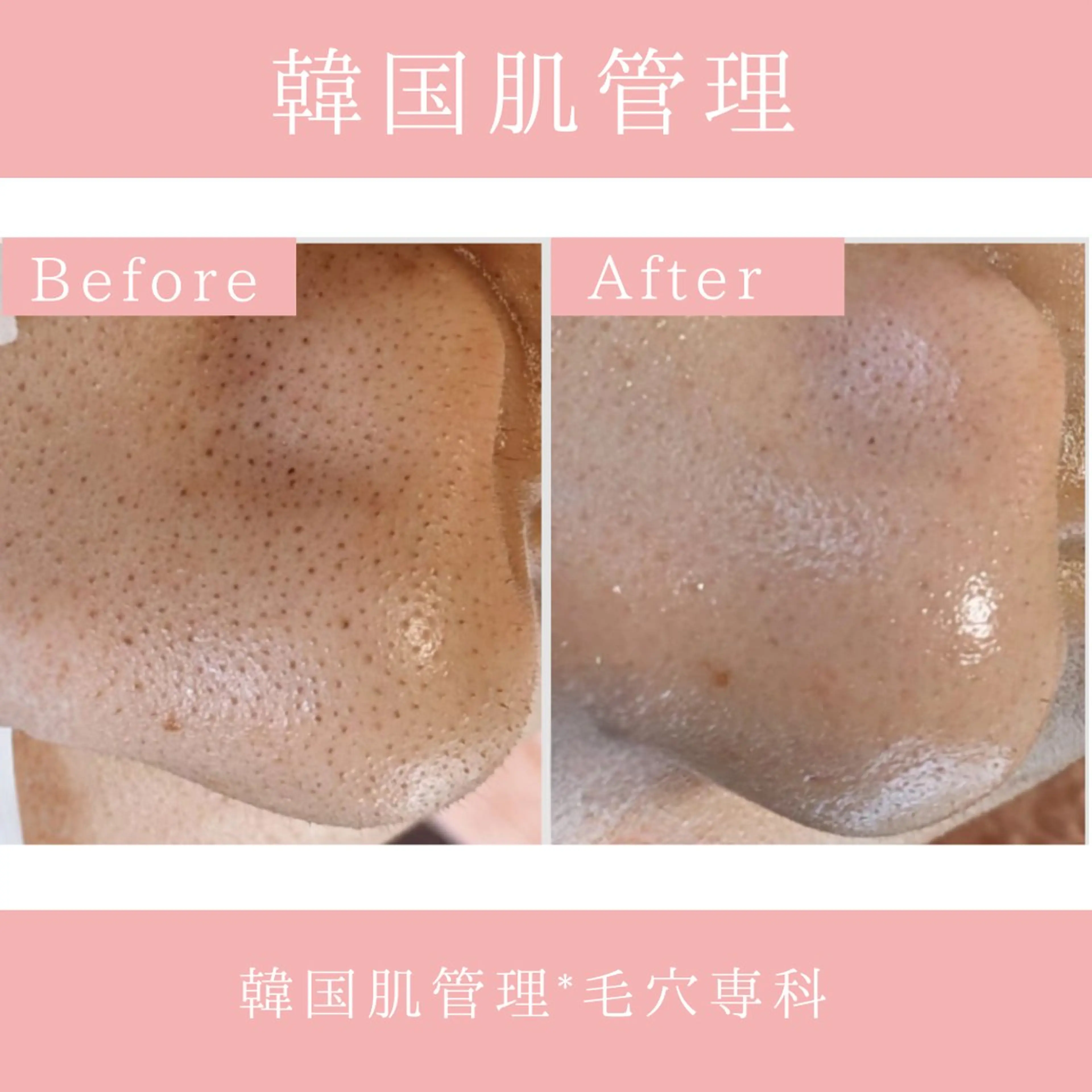 エステ リラク 韓国肌管理 【毛穴専科】のエステ・リラクイメージ