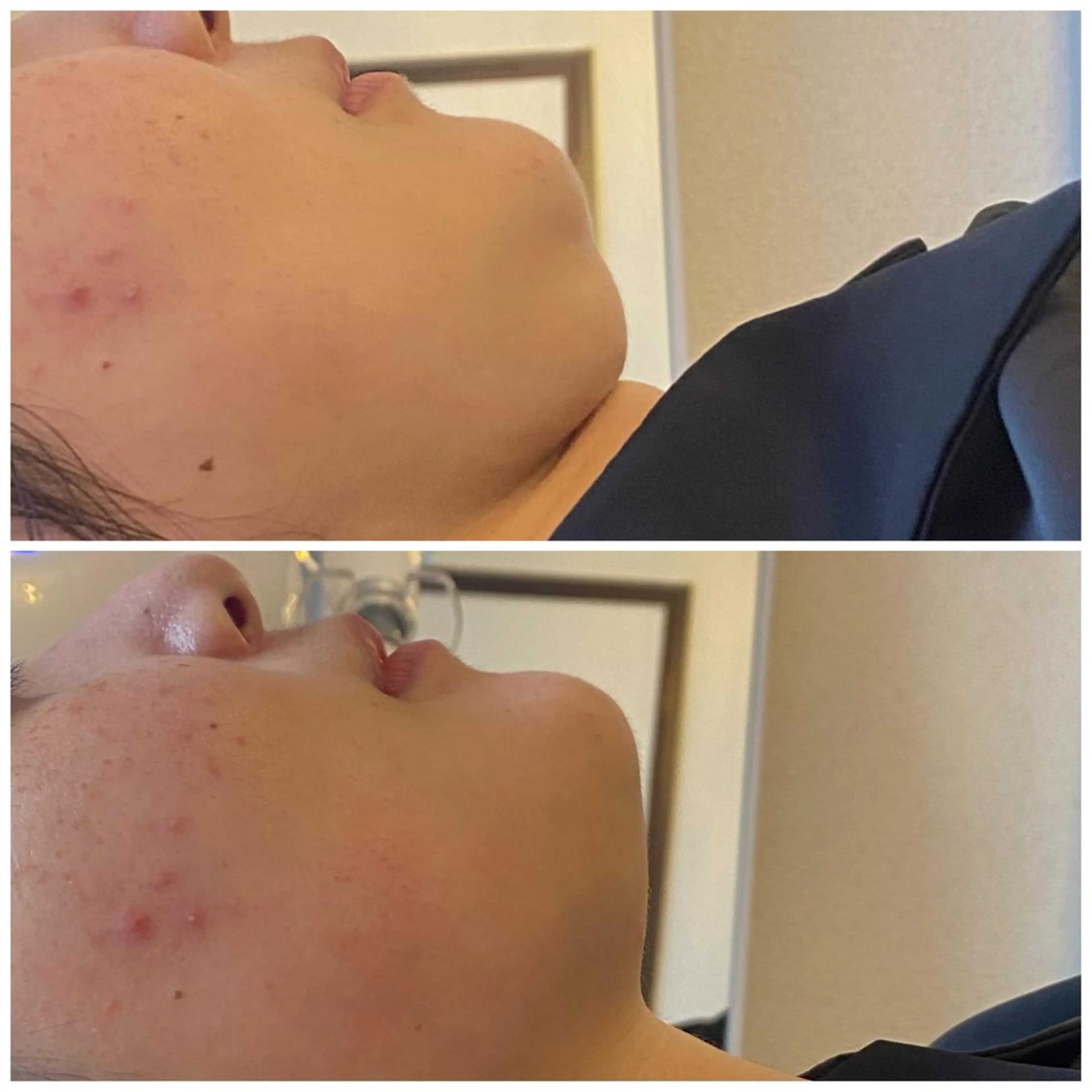 ショート カラー パーマ ヘアアレンジ メンズ キッズ ネイル マツエク・マツパ アイブロウ エステ snow flakeのエステ・リラクイメージ