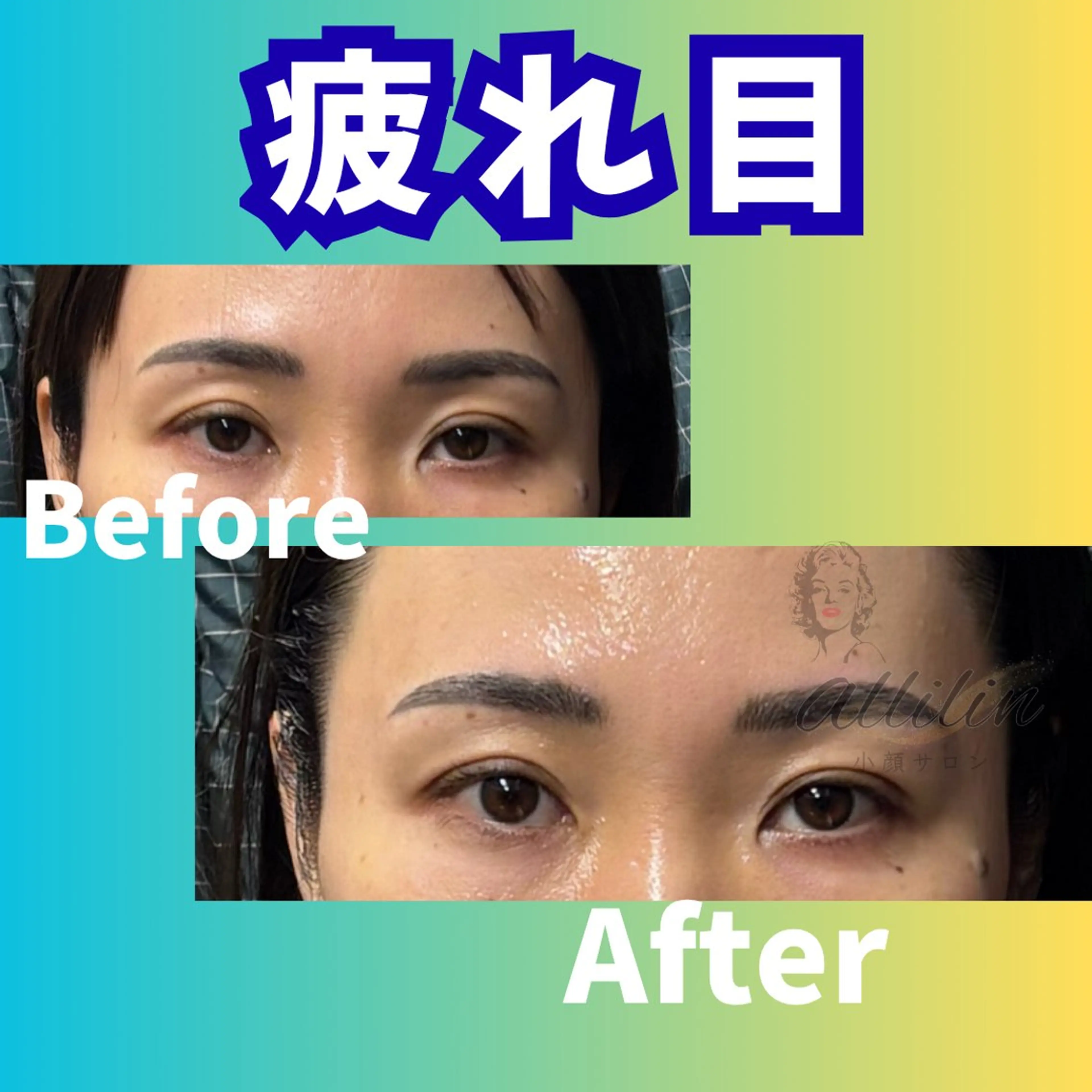 💎小顔サロン アリリン銀座💎のエステ・リラクイメージ