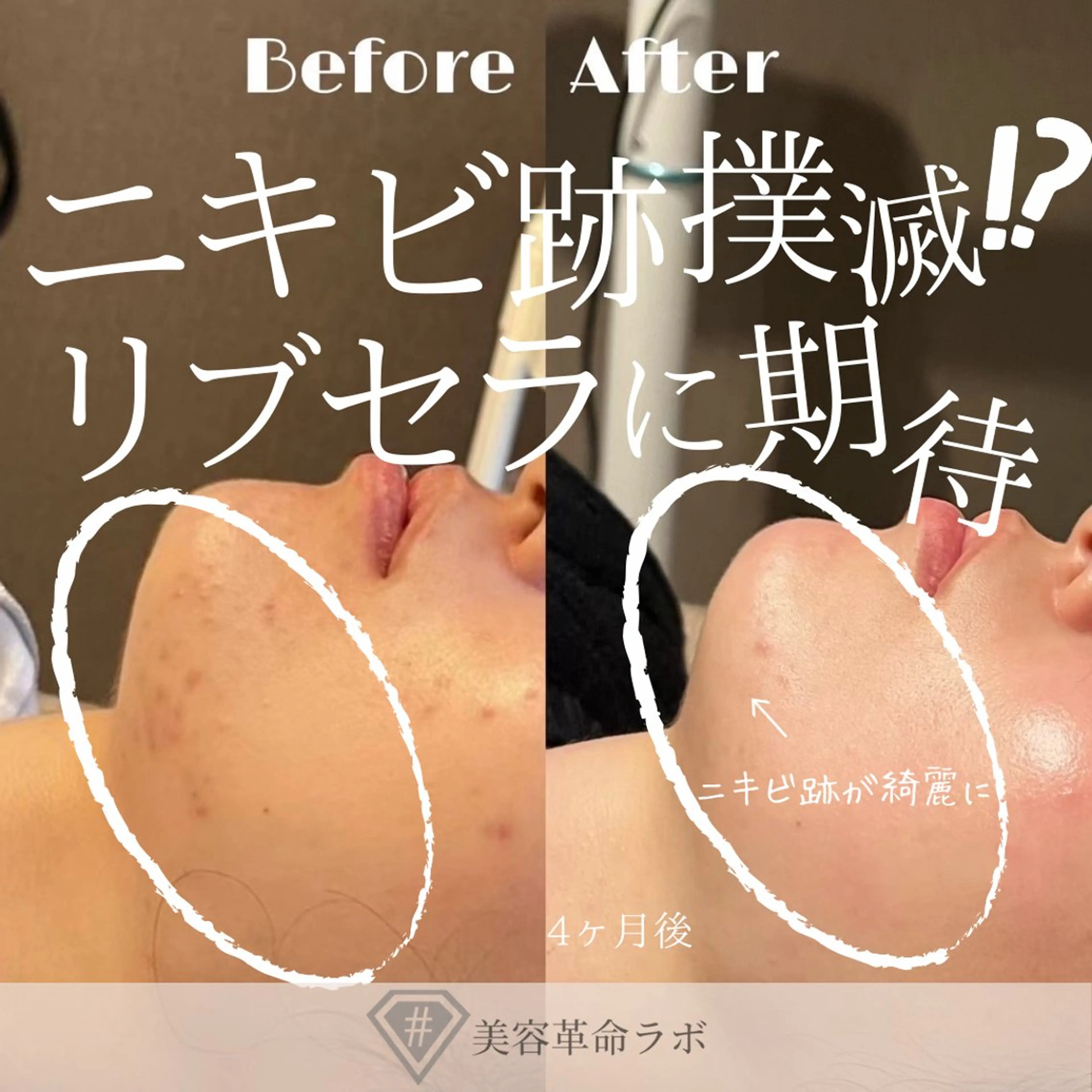 💎美容革命ラボ💎 大名店のエステ・リラクイメージ