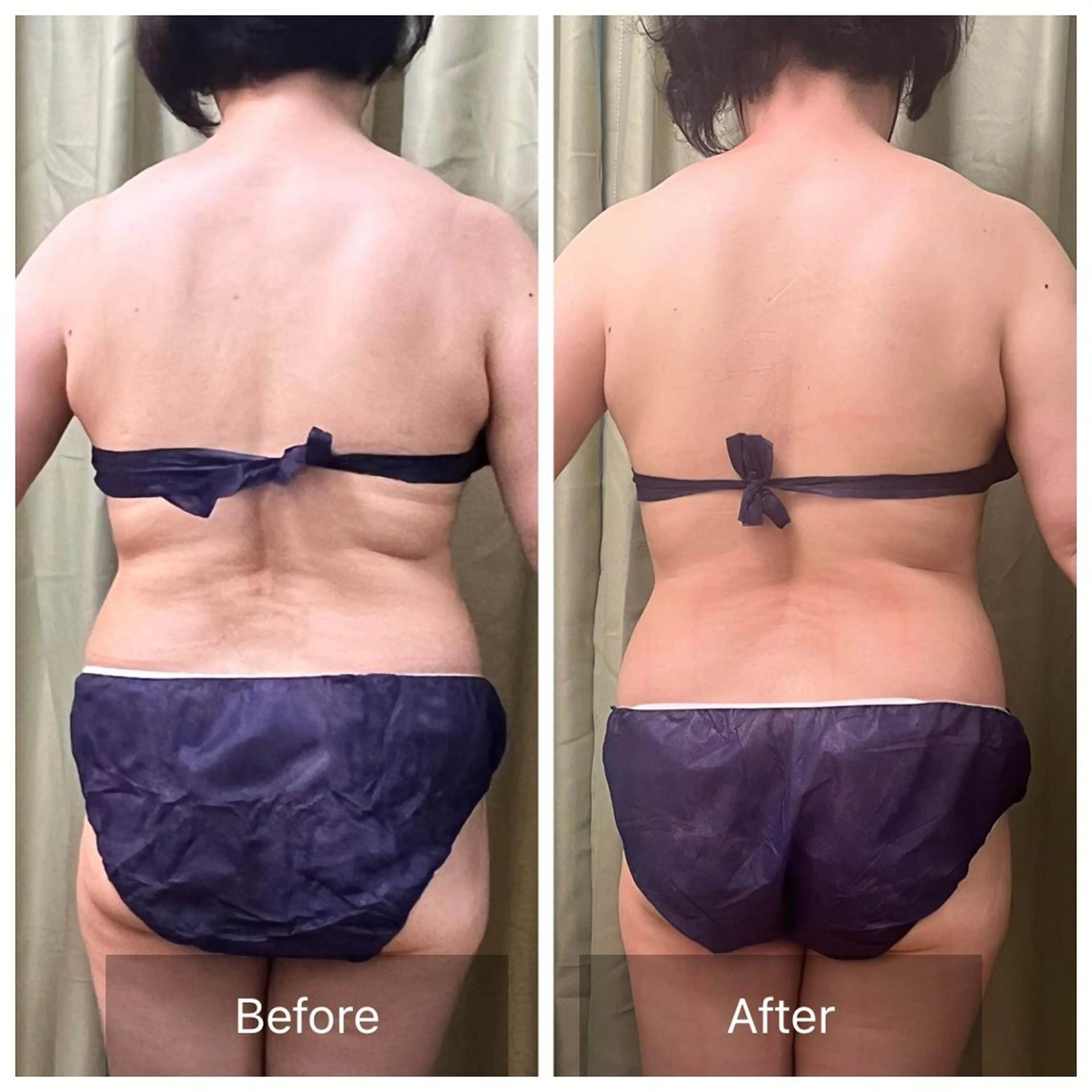 【選べる2パーツ】完全オーダーメイド/キャビテーション×ラジオ派＋痩身リンパマッサージ30分メンズにも⭕️の写真