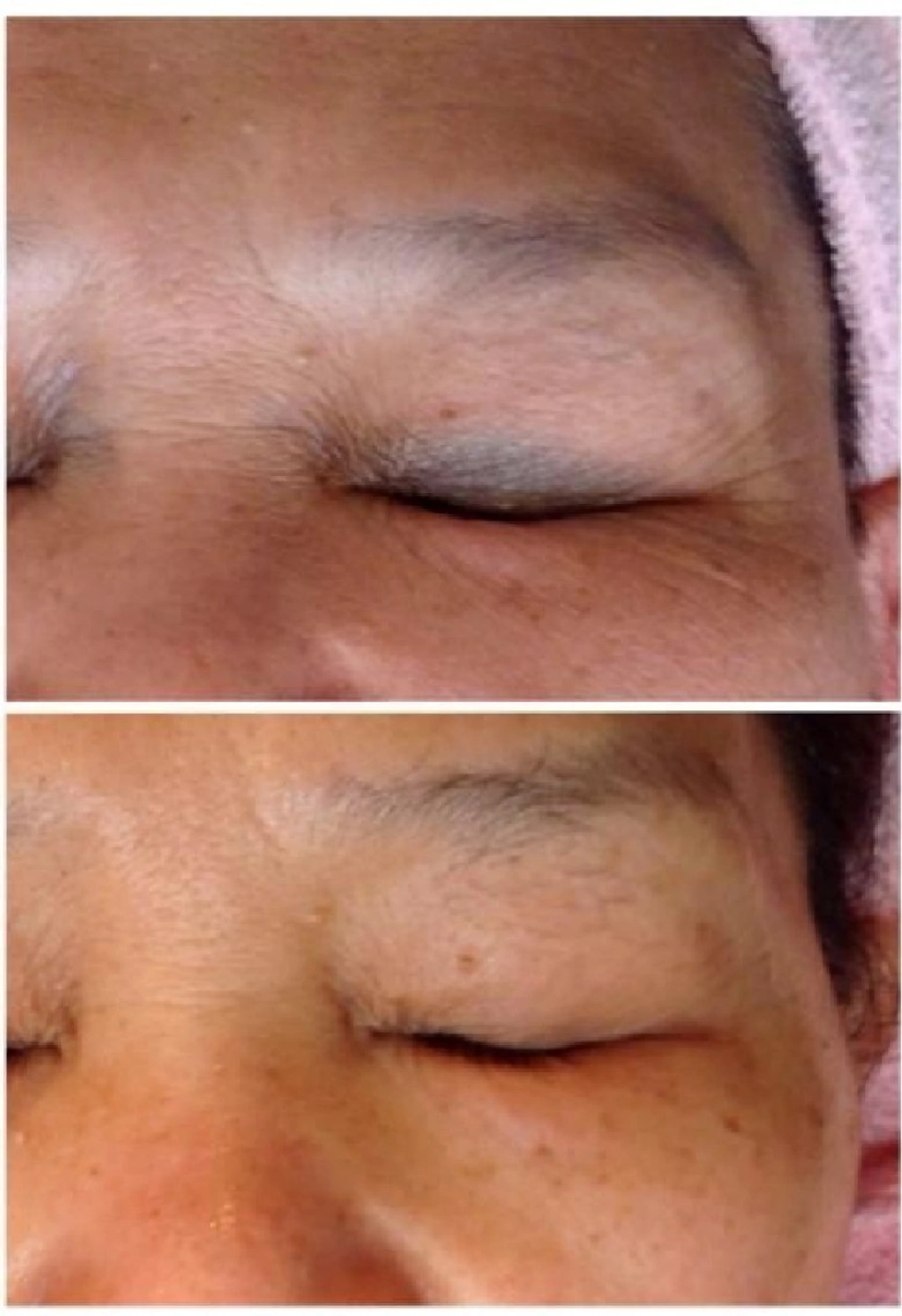 エステ LOUISE.／脱毛所属・LOUISE. ／脱毛のエステ・リラクイメージ