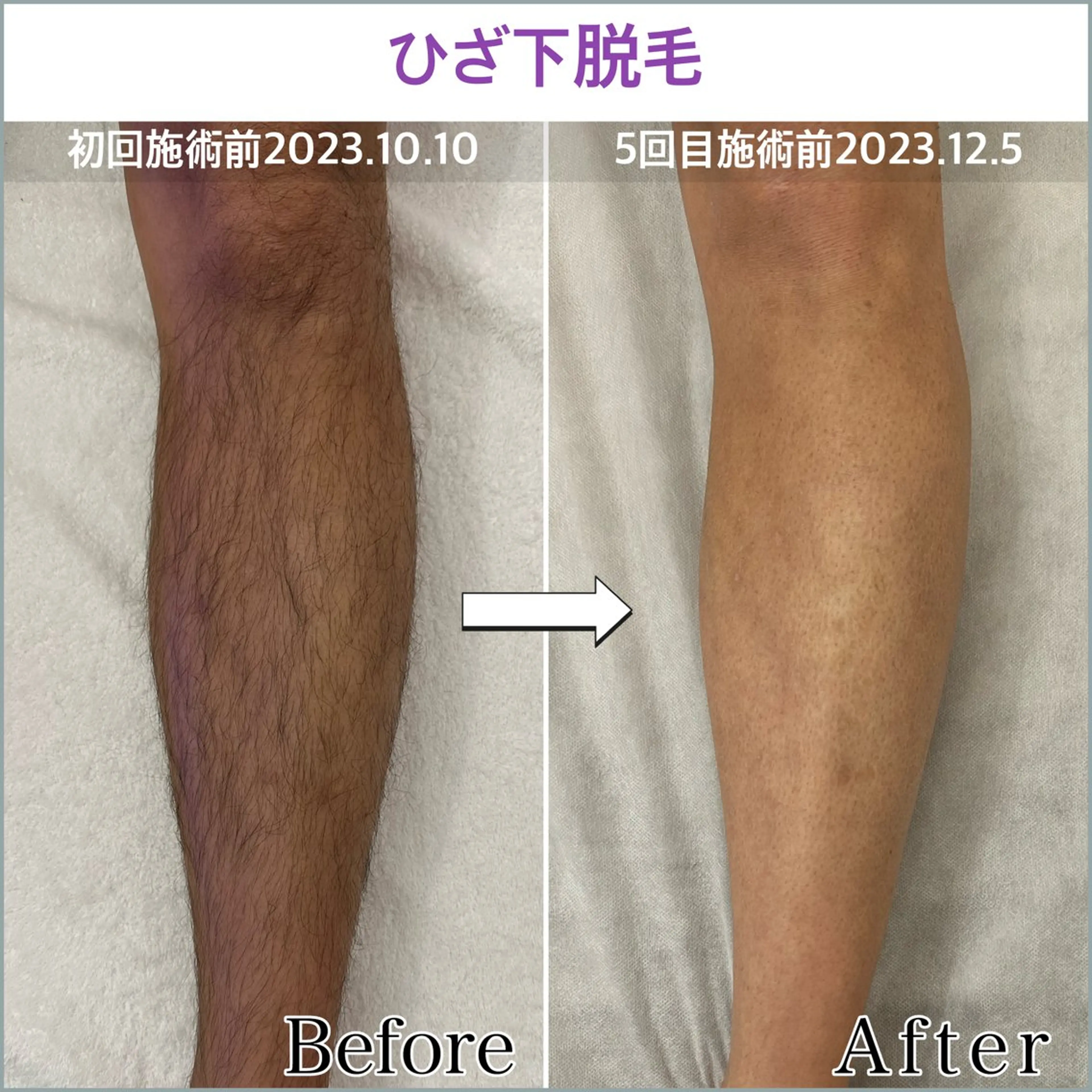 プライベートサロン エル〜aile～のエステ・リラクイメージ