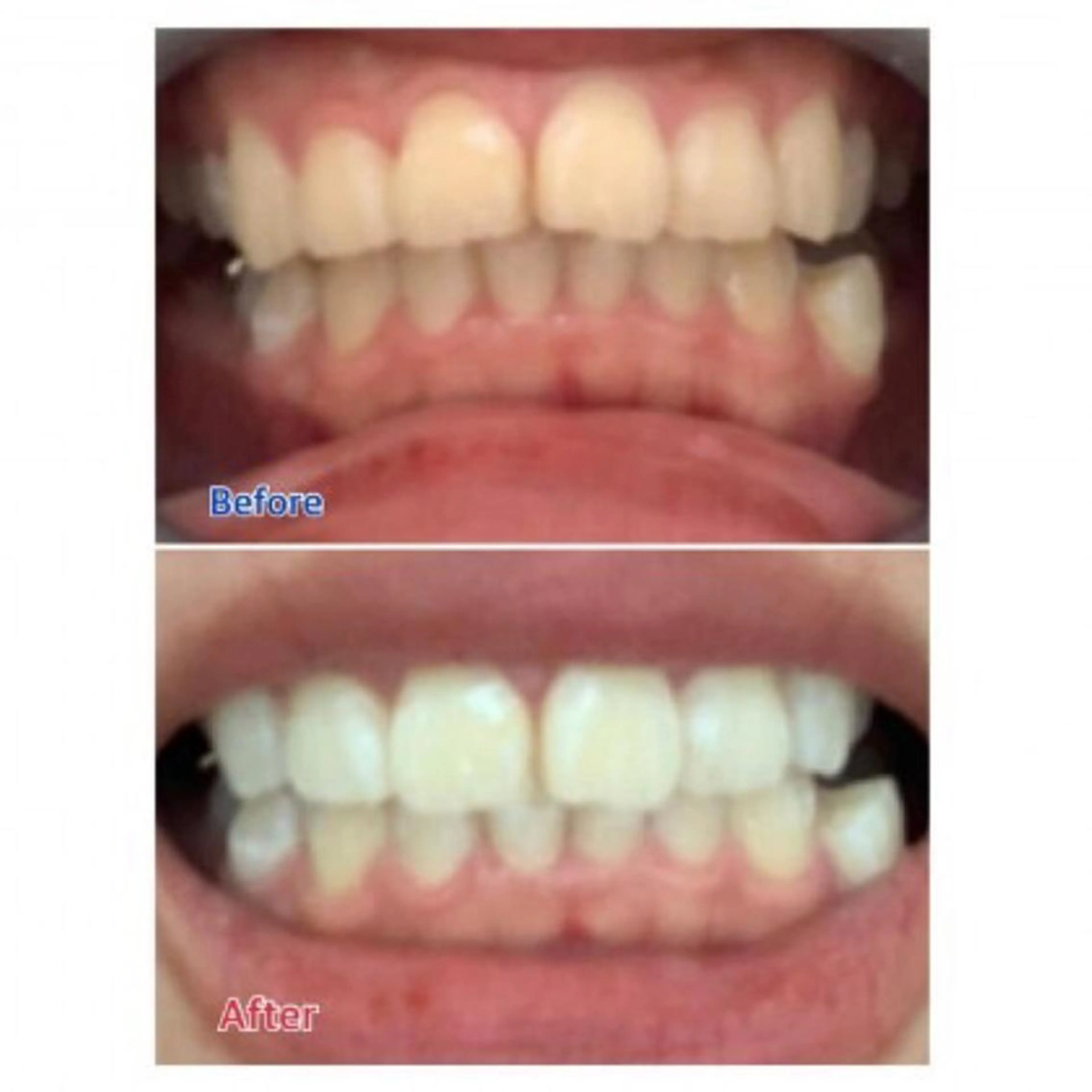 Ｍ渋谷 ホワイトニングのエステ・リラクイメージ