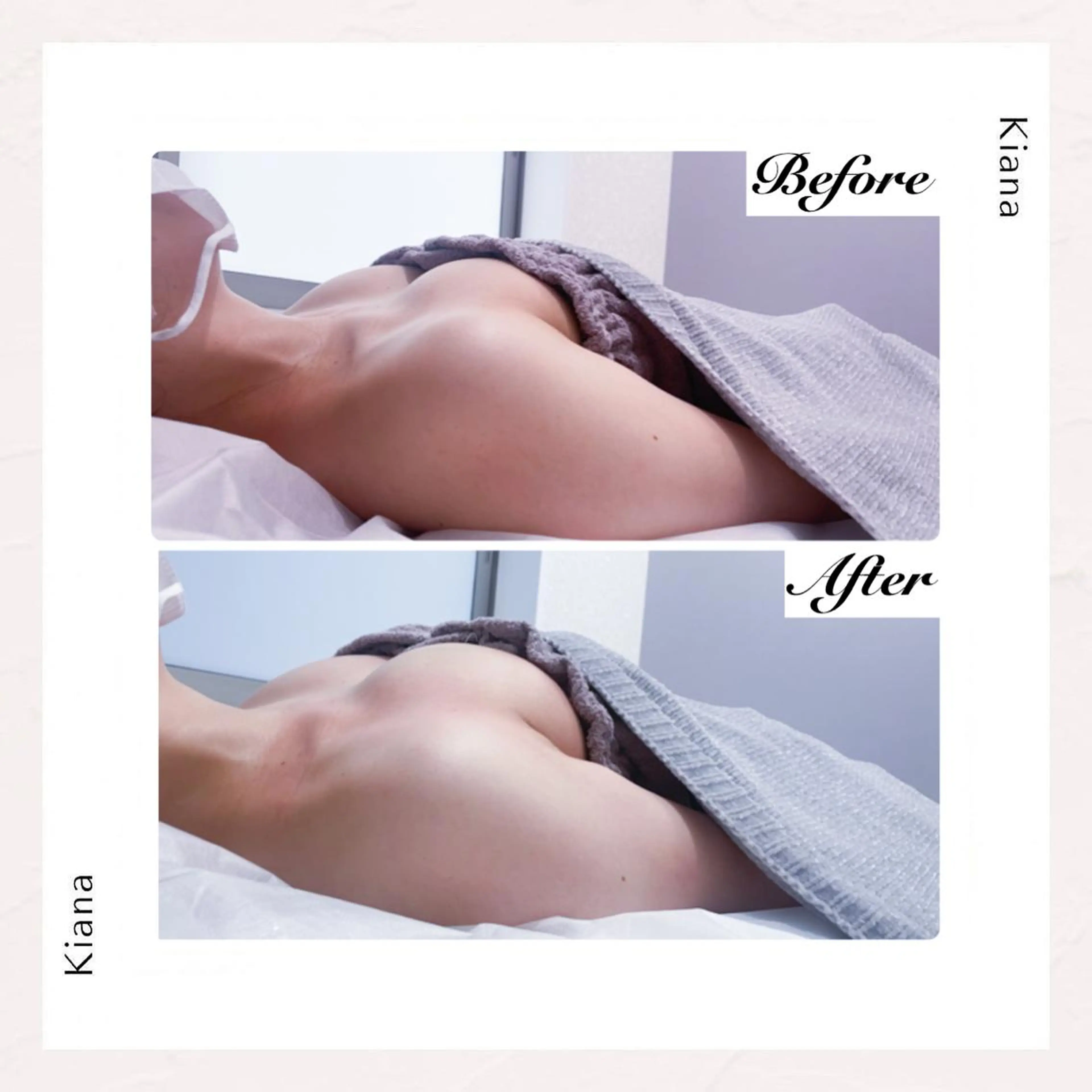 エステ リラク バスト専門Kiana 風のエステ・リラクイメージ