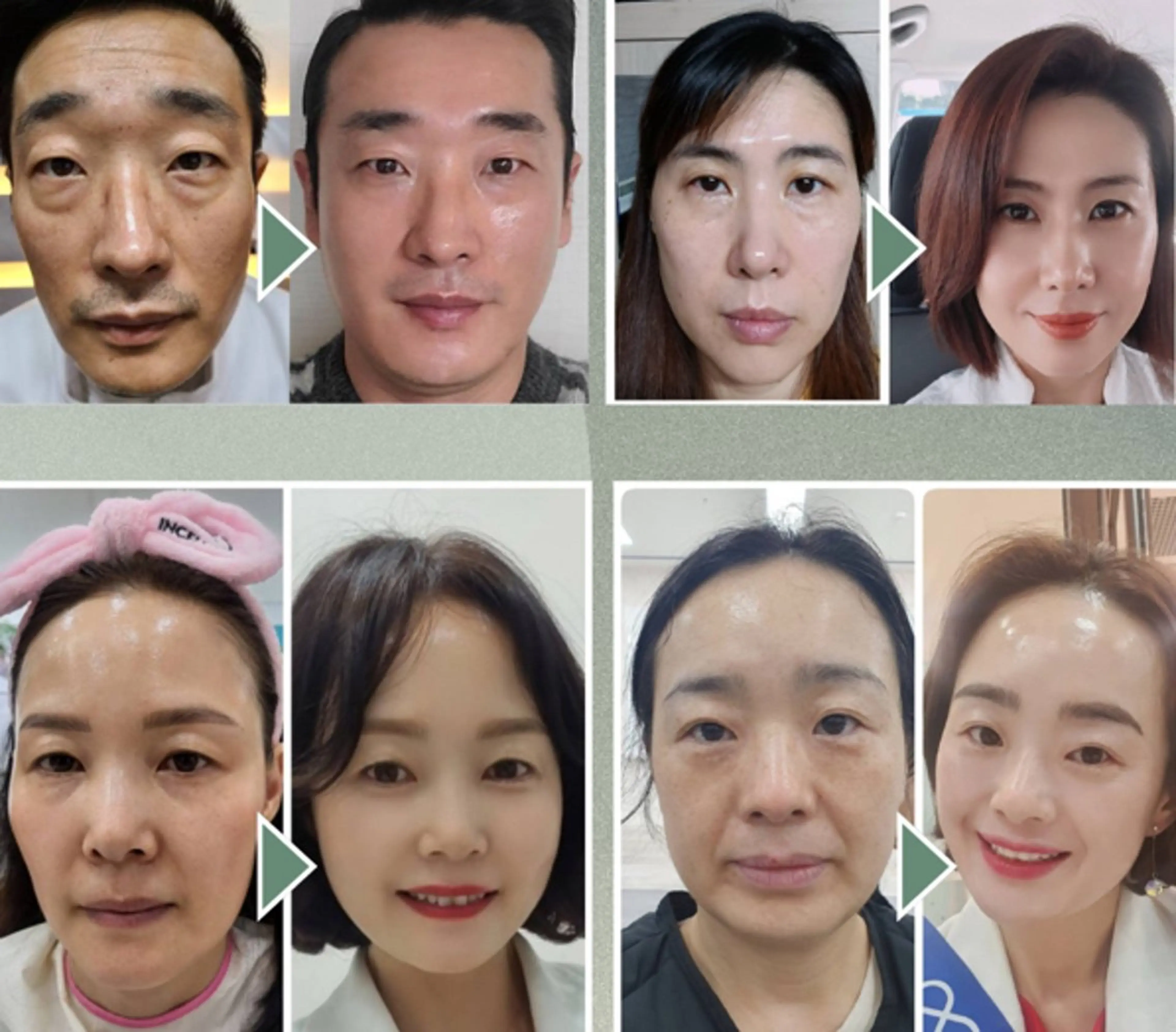 【韓国美容】インセルダム  急速肌改善！ツヤ肌への写真