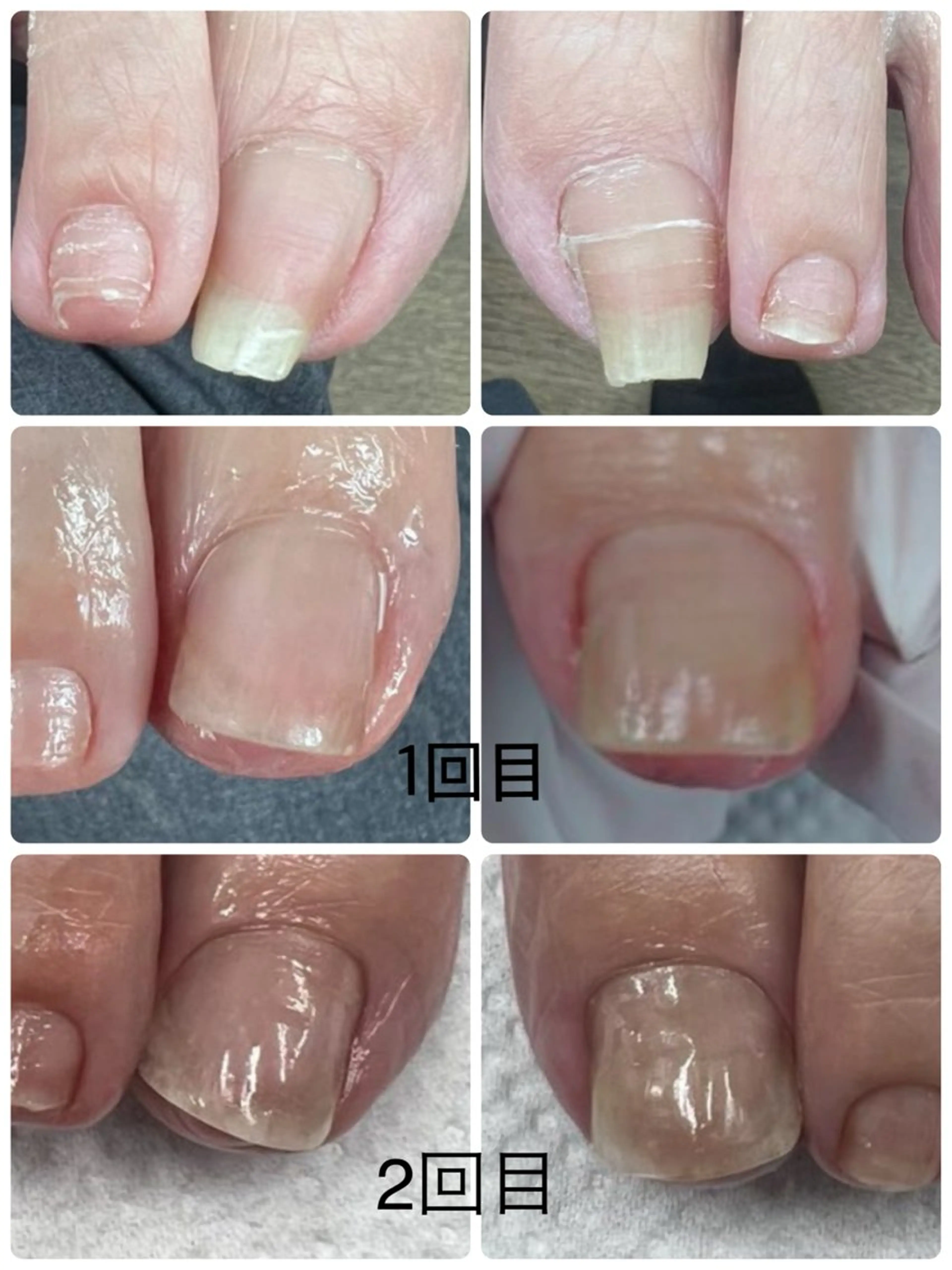 ネイル Belulu ベルルのネイルデザイン