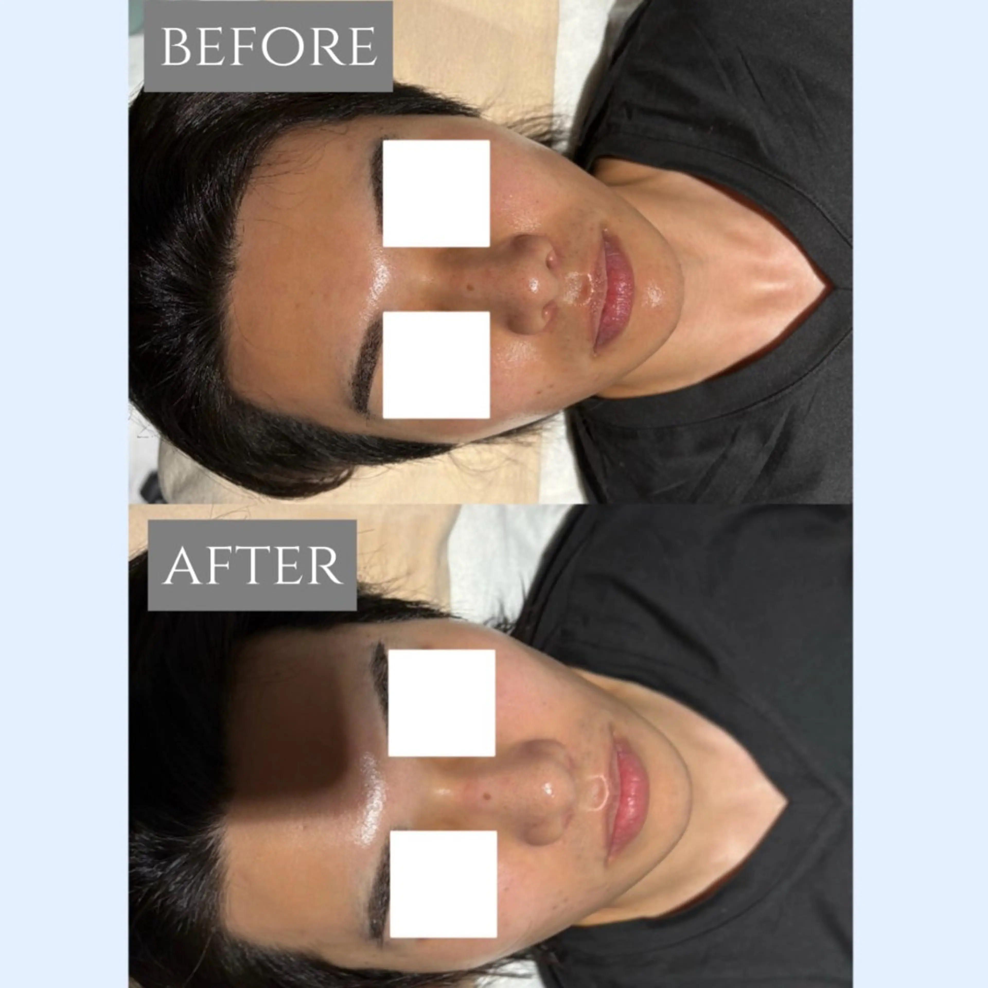 🎀肌質改善🫧 小山のエステ・リラクイメージ