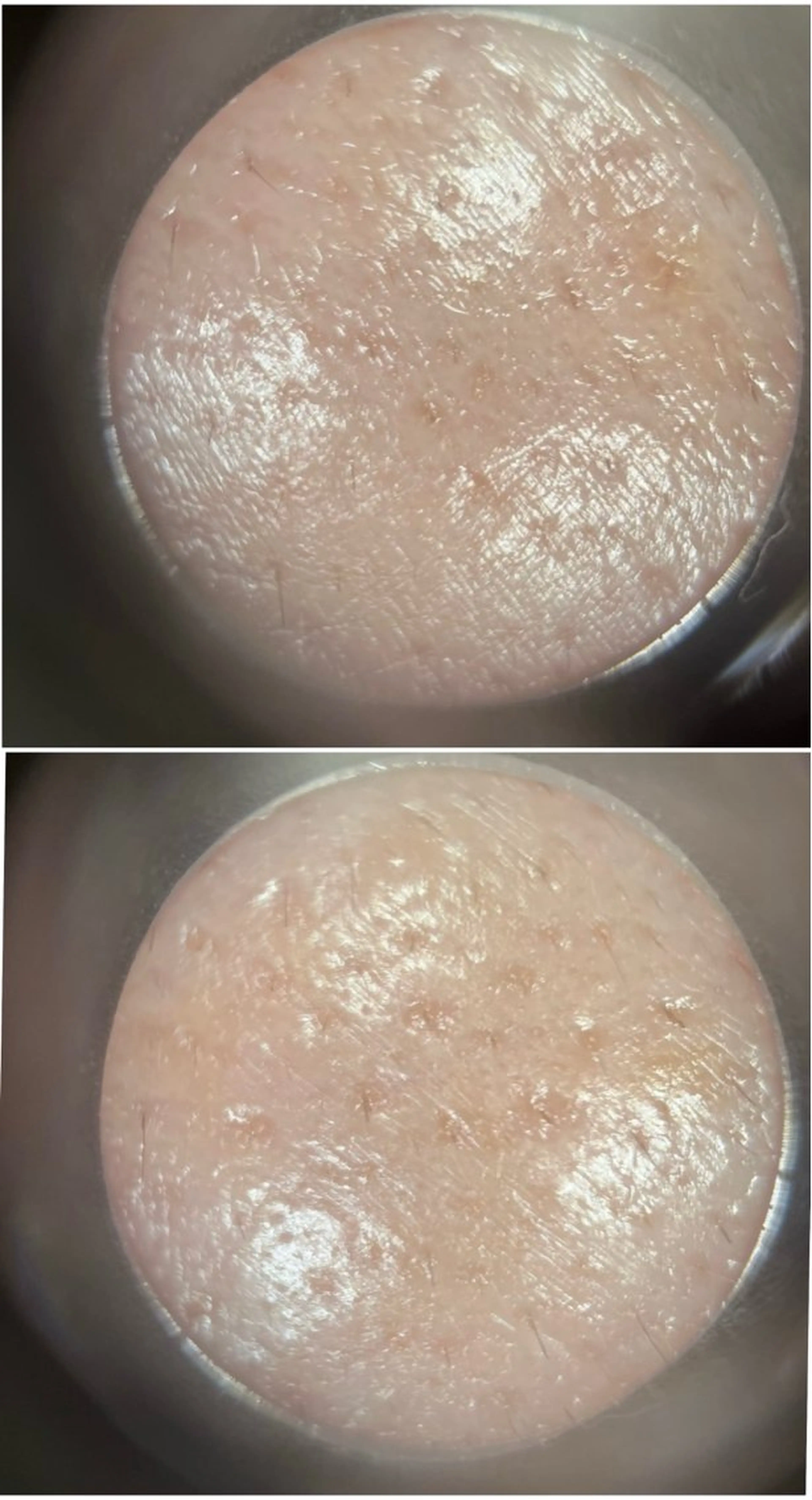 メナード伊勢崎 宮子西erinaのエステ・リラクイメージ